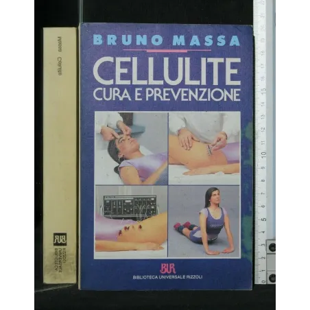 CELLULITE CURA E PREVENZIONE