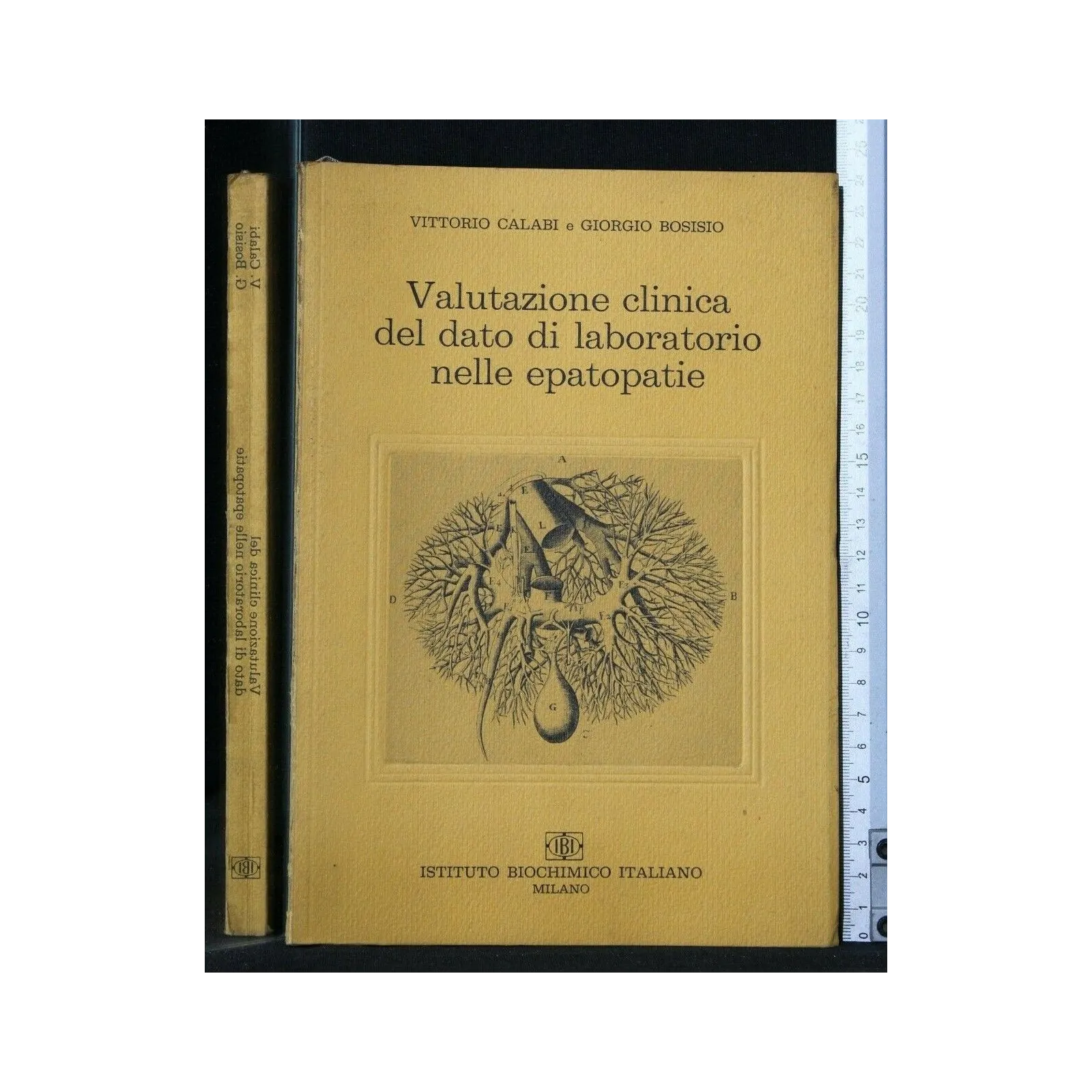 VALUTAZIONE CLINICA DEL DATO DI LABORATORIO NELLE EPATOPATIE