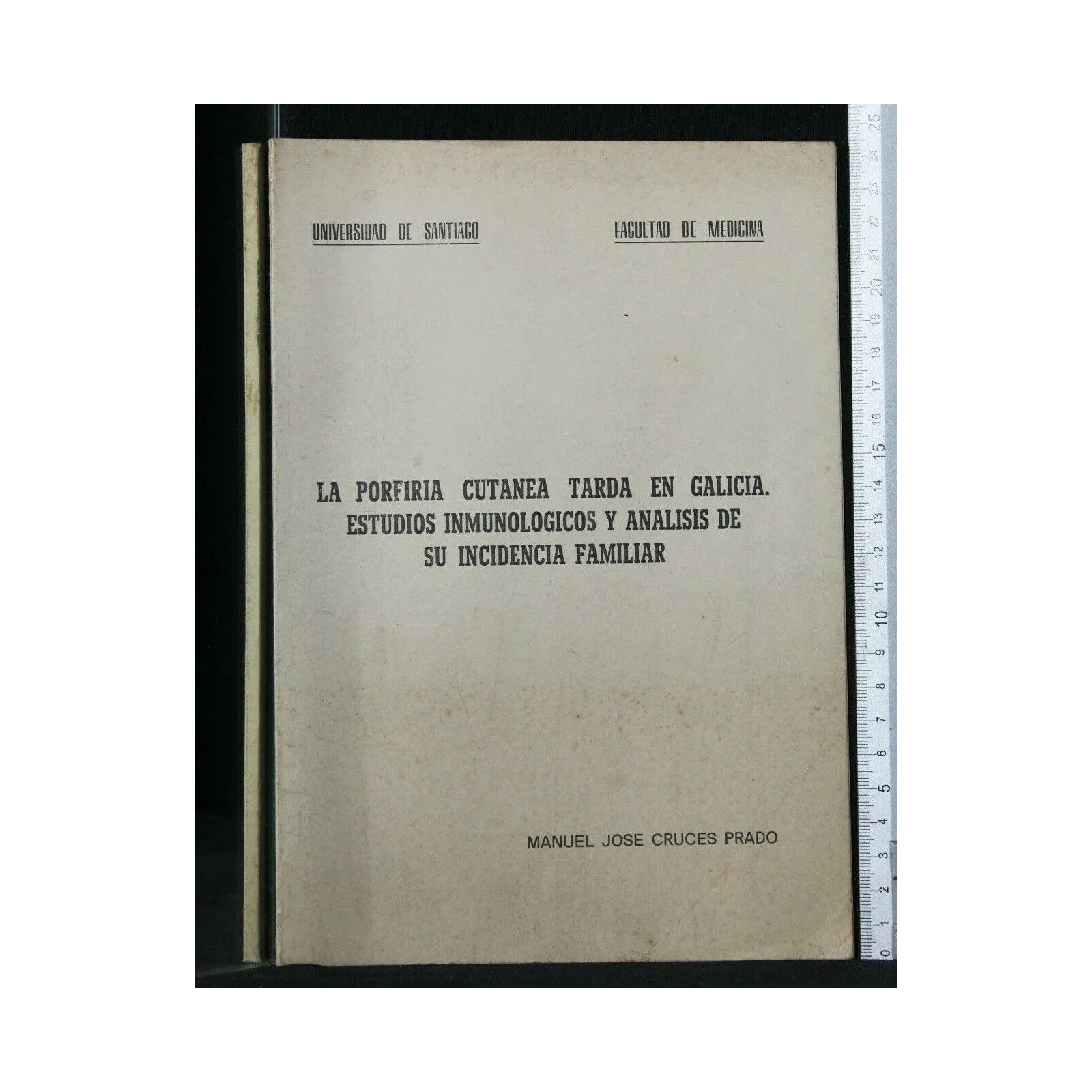 LA PORFIRIA CUTANEA TARDA EN GALICIA ESTUDIOS INMUNOLOGICOS Y
