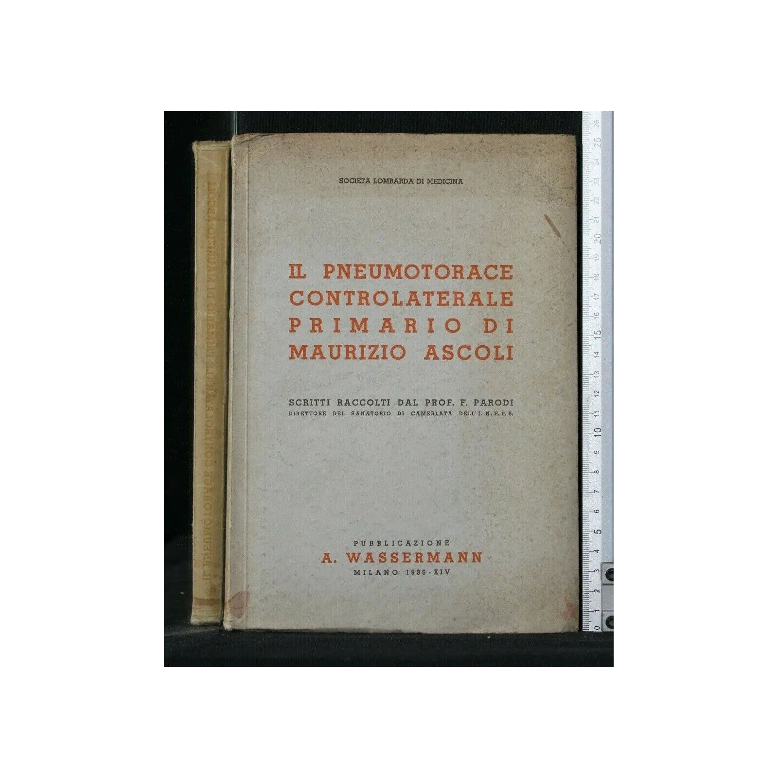 IL PNEUMOTORACE CONTROLATERALE PRIMARIO DI MAURIZIO ASCOLI