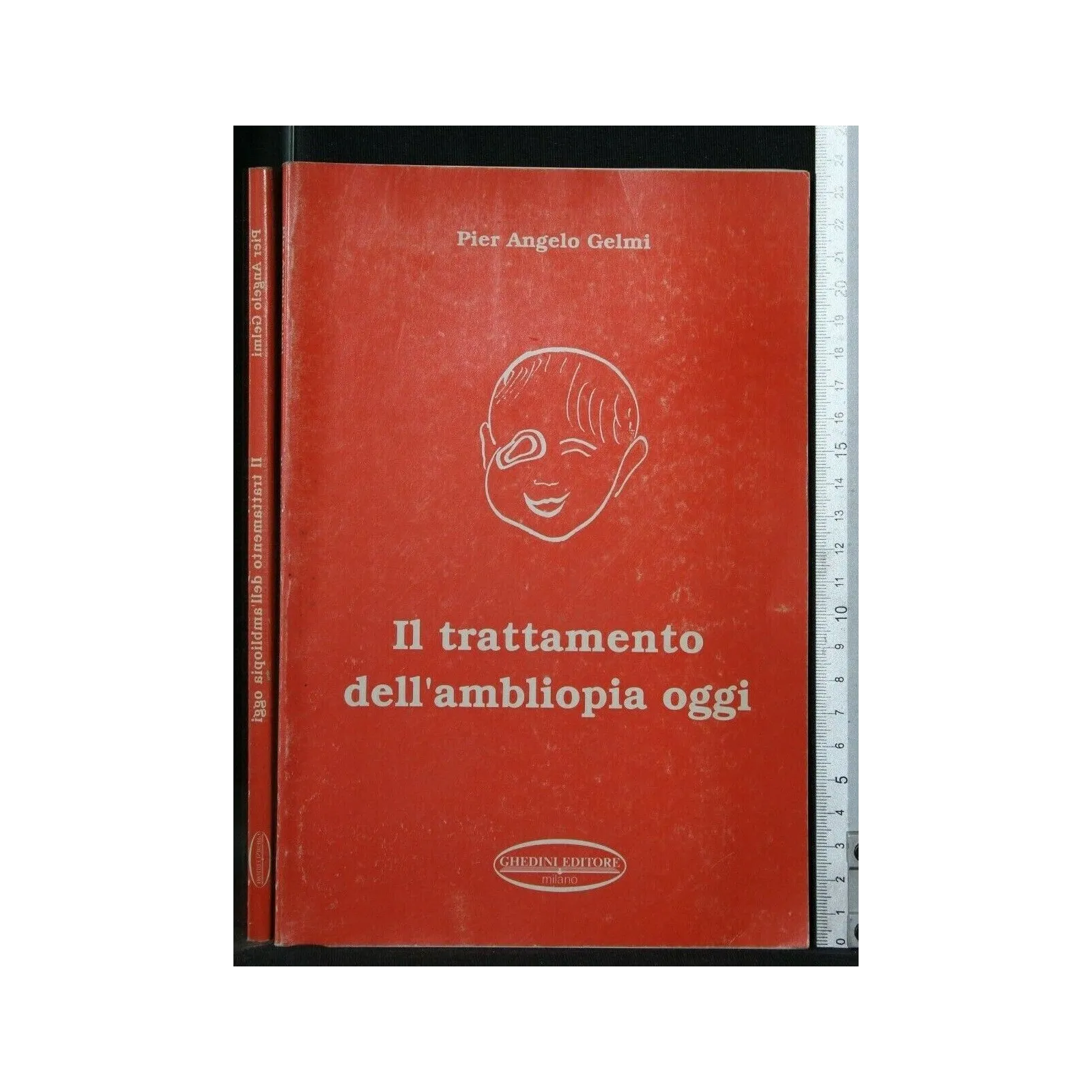IL TRATTAMENTO DELL'AMBLIOPIA OGGI