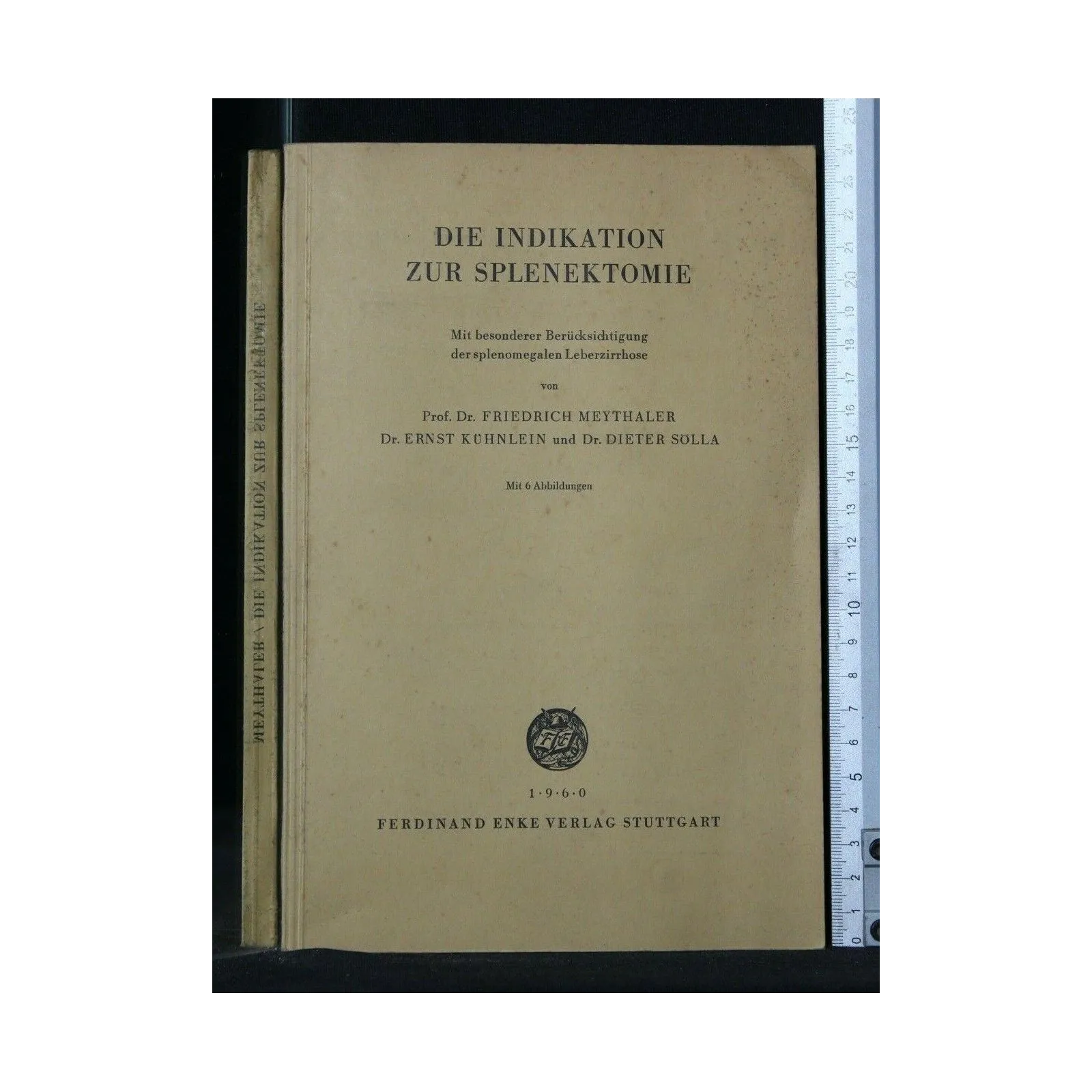 DIE INDIKATION ZUR SPLENEKTOMIE