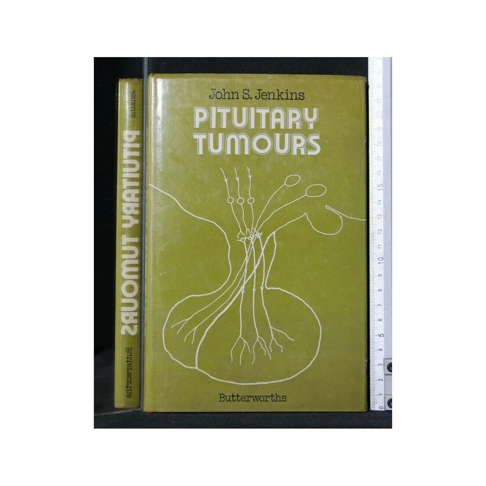 PITUITARY TUMOURS