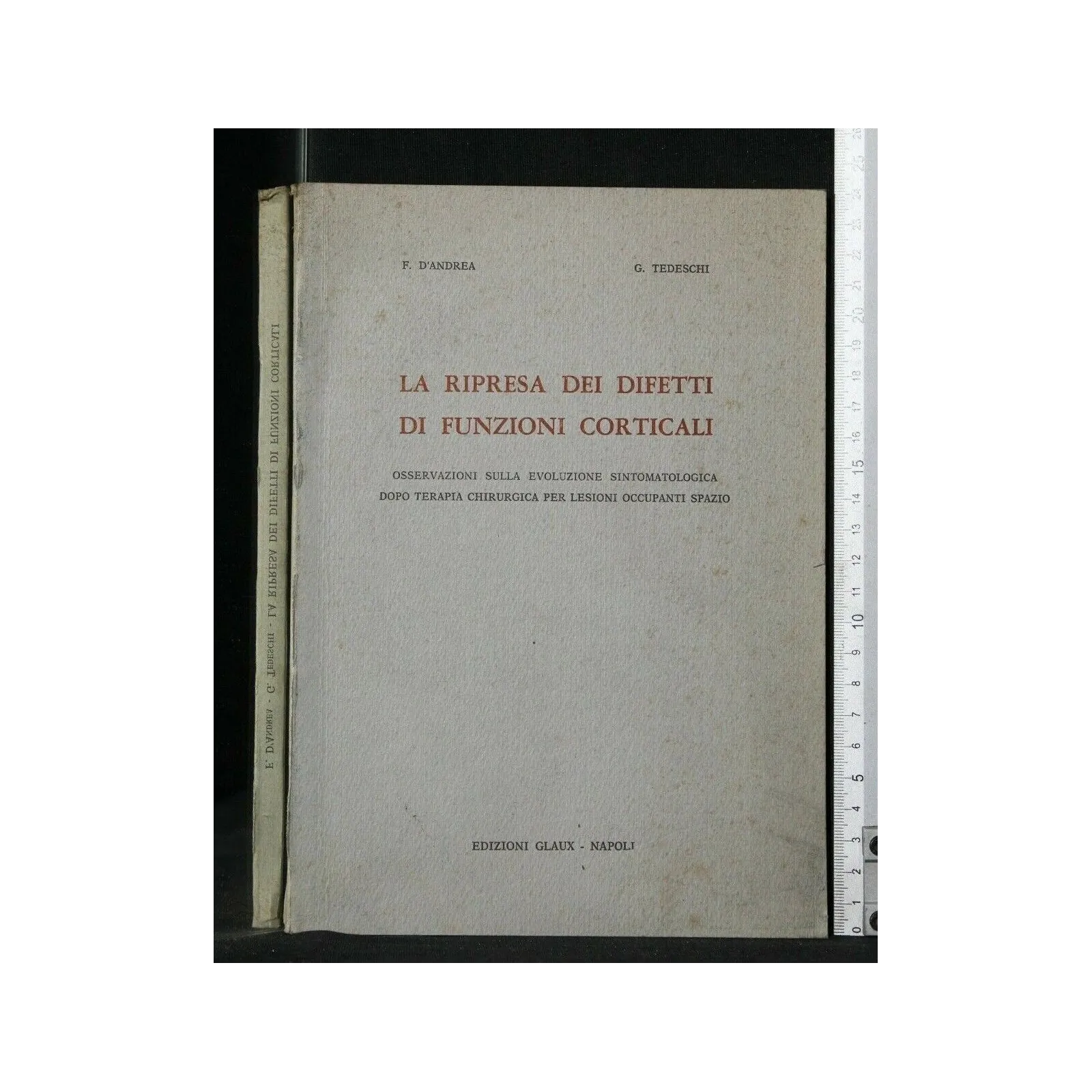 LA RIPRESA DEI DIFETTI DI FUNZIONI CORTICALI