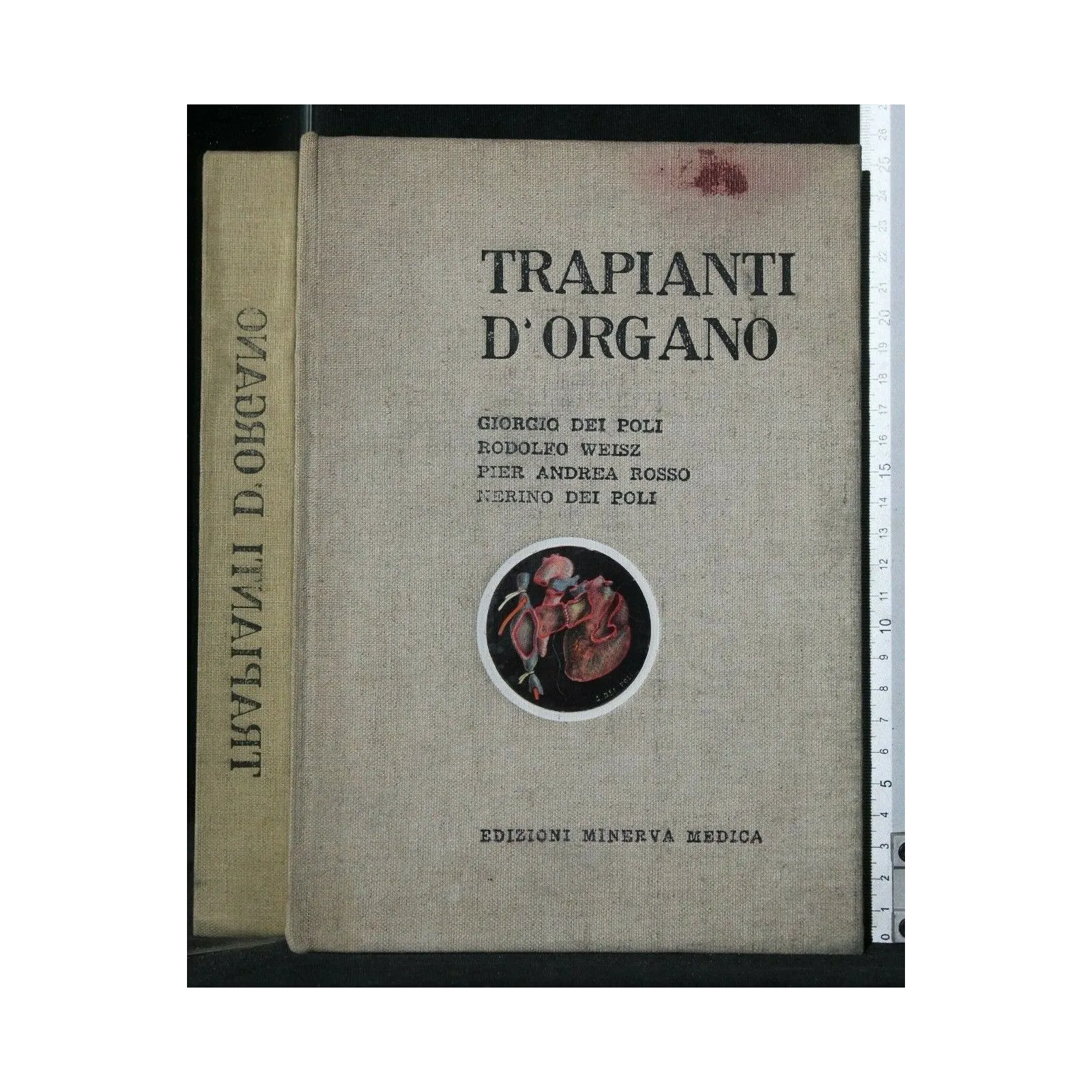 TRAPIANTI D'ORGANO