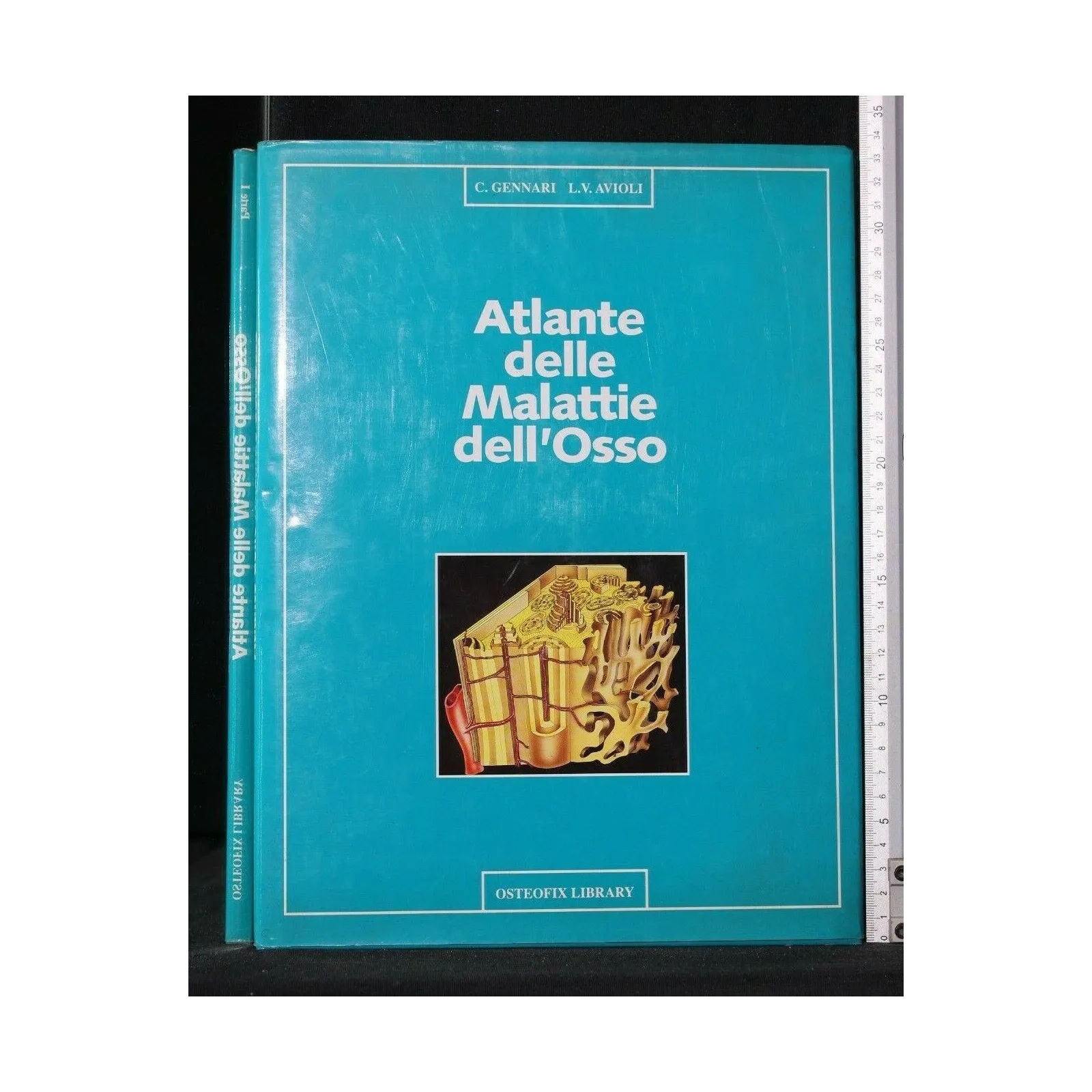 ATLANTE DELLE MALATTIE DELL'OSSO 2 VOLUMI PARTE I, II