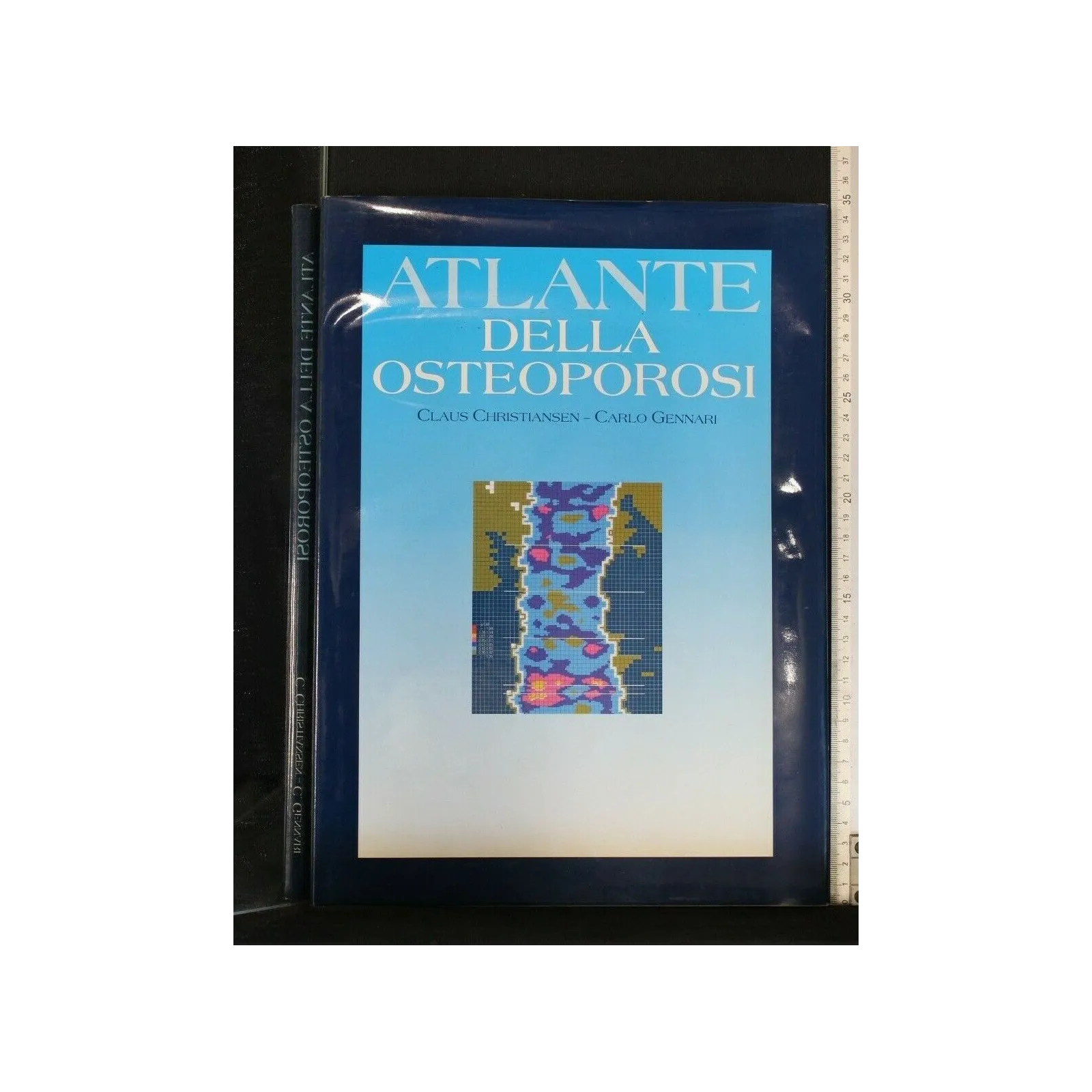 ATLANTE DELLA OSTEOPOROSI