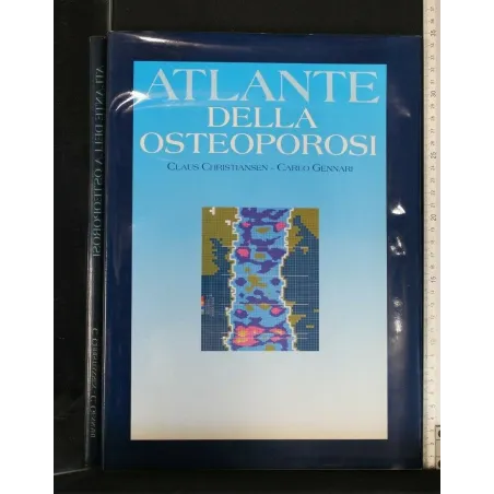 ATLANTE DELLA OSTEOPOROSI