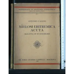 MIELOSI ERITREMICA ACUTA