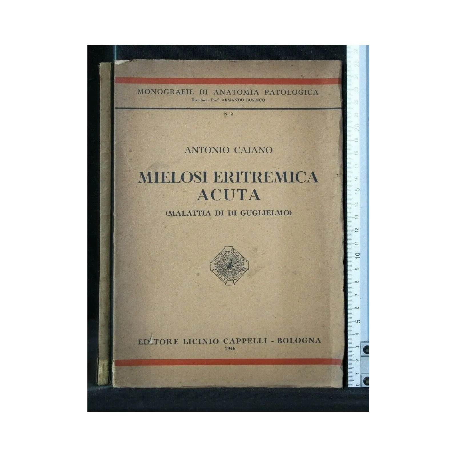 MIELOSI ERITREMICA ACUTA