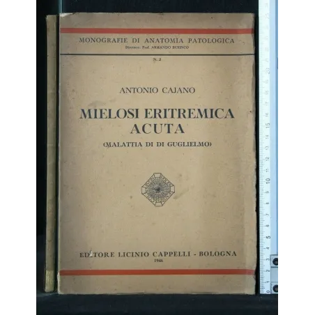 MIELOSI ERITREMICA ACUTA