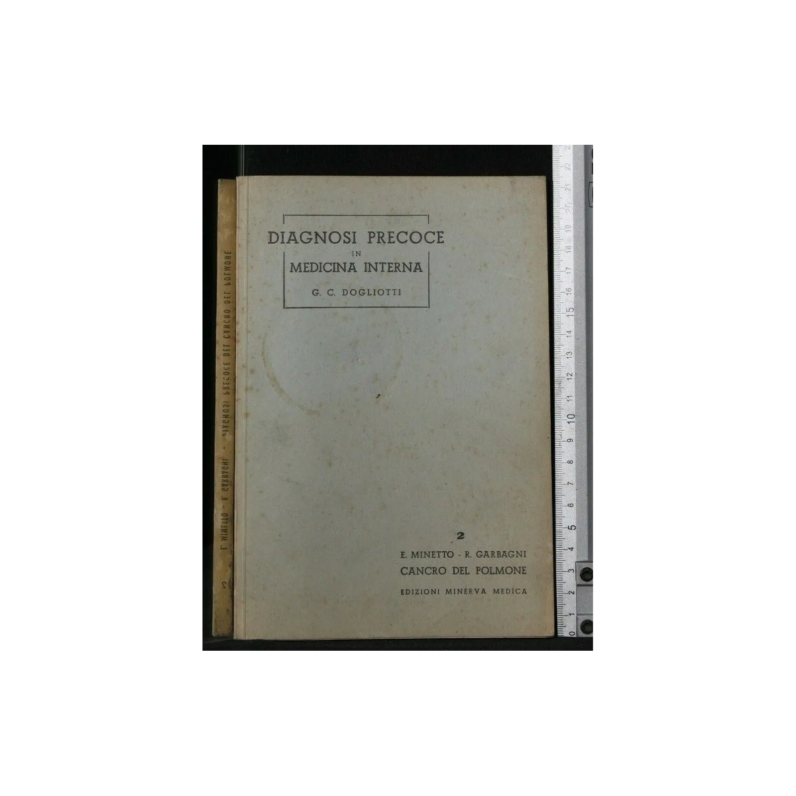 DIAGNOSI PRECOCE DEL CANCRO DEL POLMONE