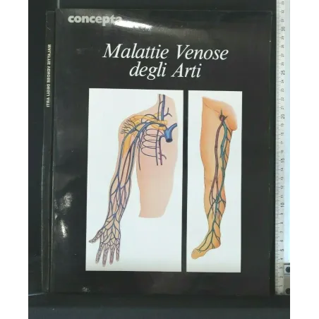MALATTIE VENOSE DEGLI ARTI