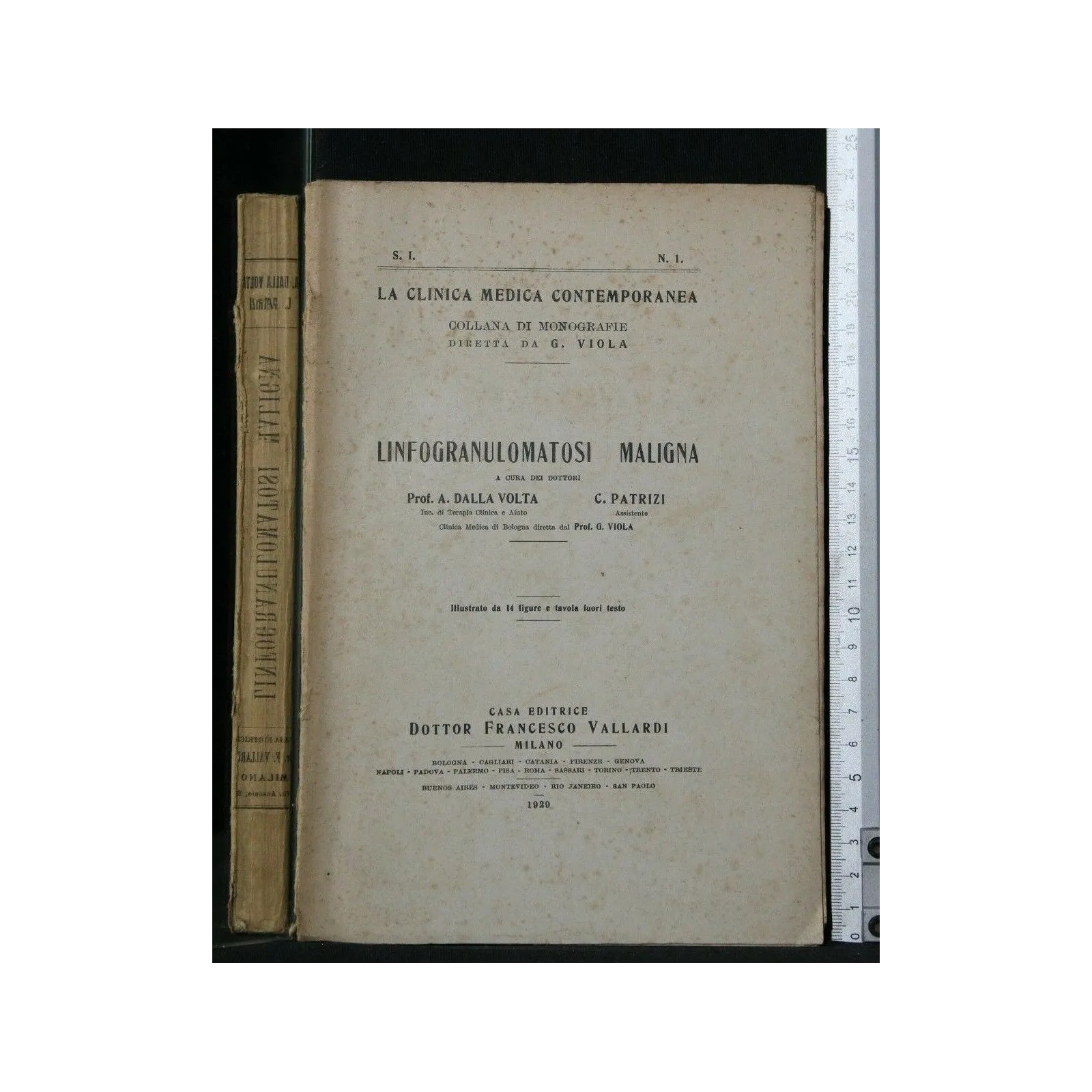 LINFOGRANULOMATOSI MALIGNA