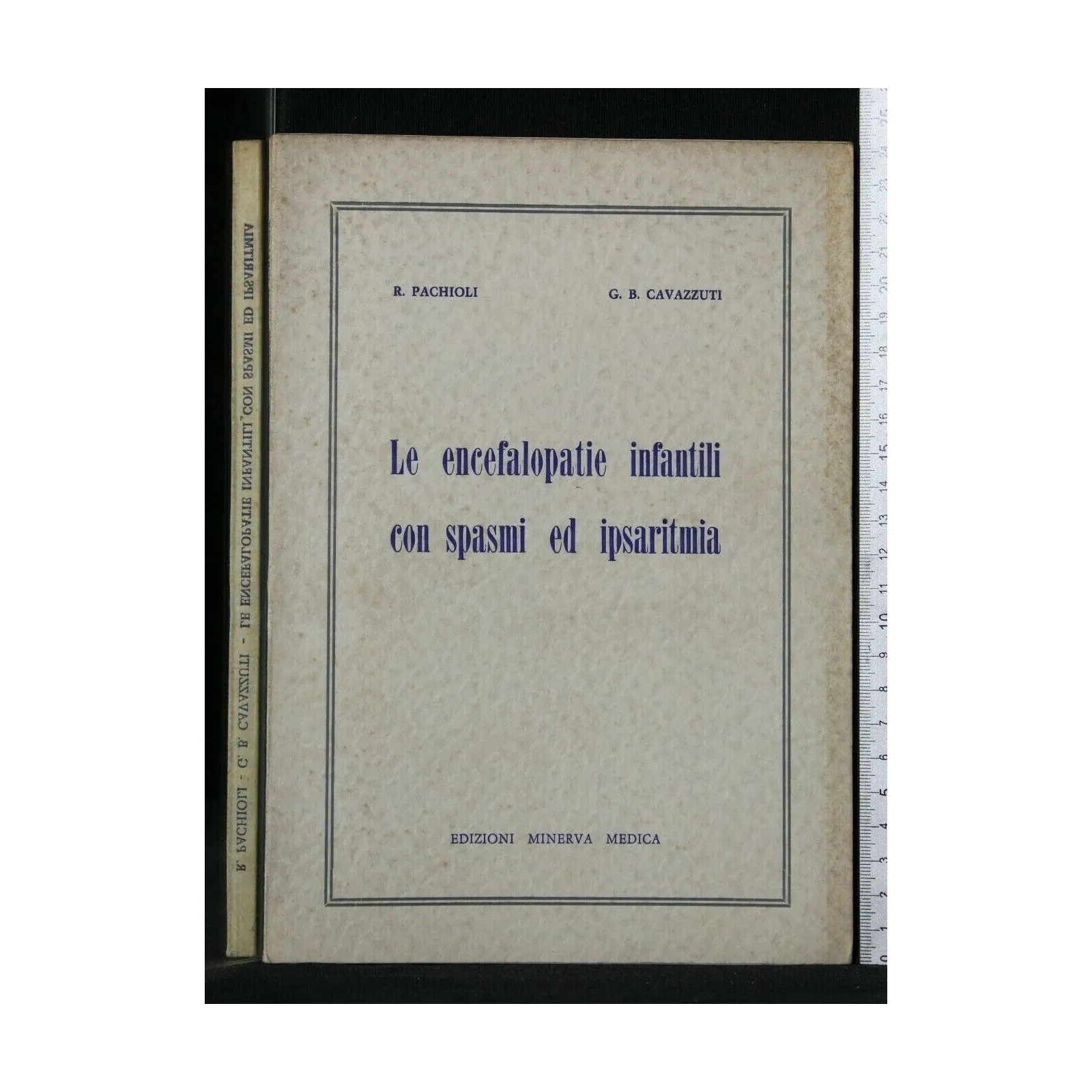 LE ENCEFALOPATIE INFANTILI CON SPASMI ED IPSARITMIA