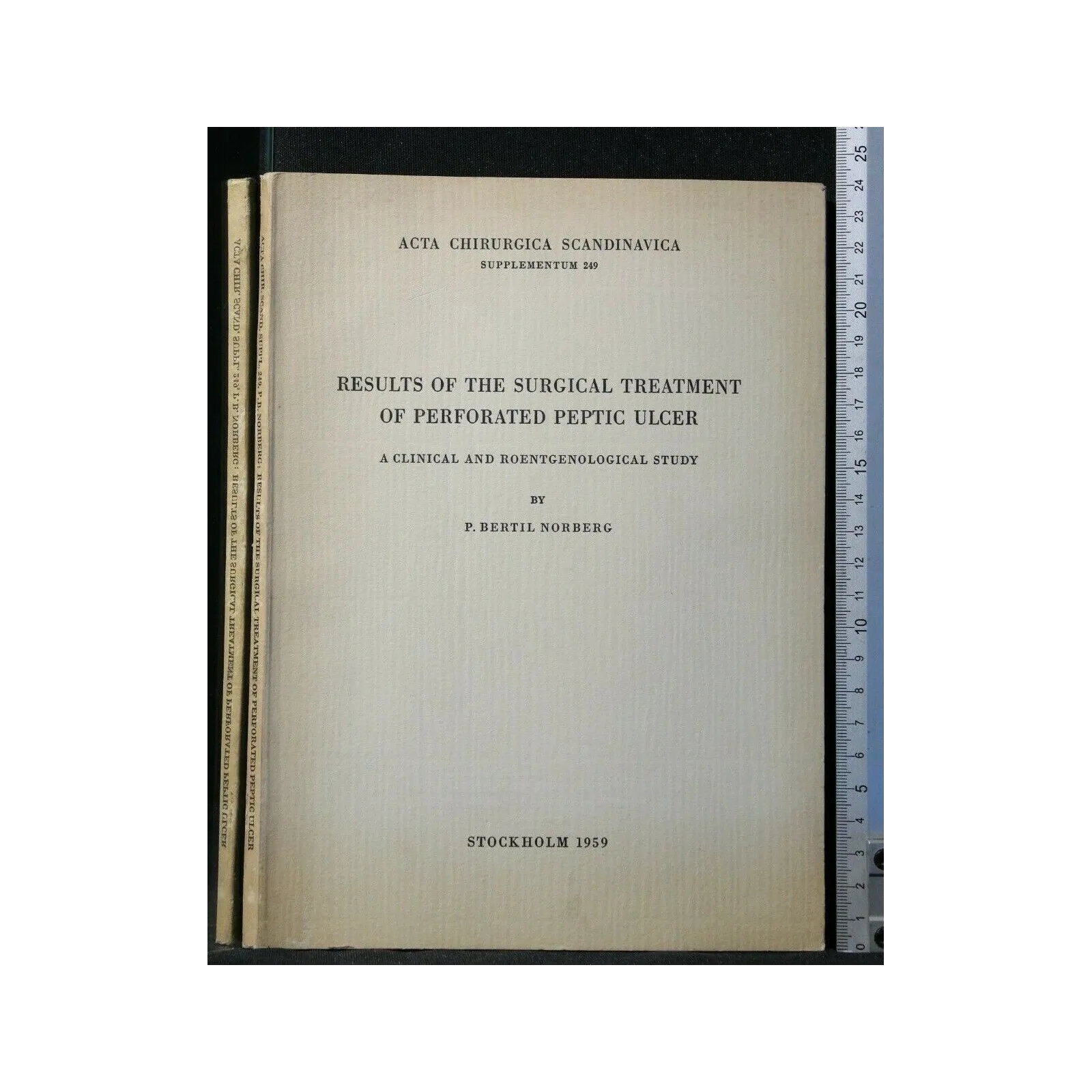 RESULTS OF THE SURGICAL TREATMENT OF PERFORATED PEPTIC ULCER