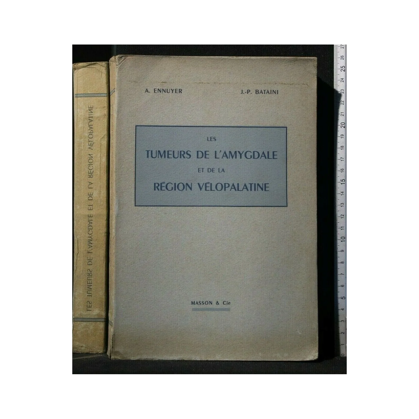 LES TUMEURS DE L'AMYGDALE ET DE LA REGION VELOPALATINE