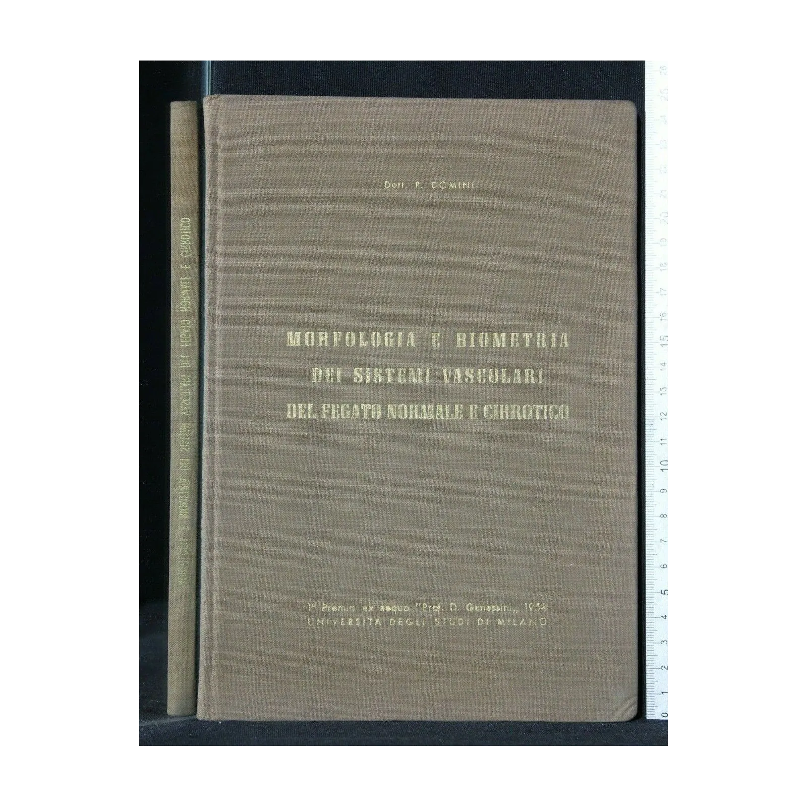 MORFOLOGIA E BIOMETRIA DEI SISTEMI VASCOLARI DEL FEGATO NORMALE