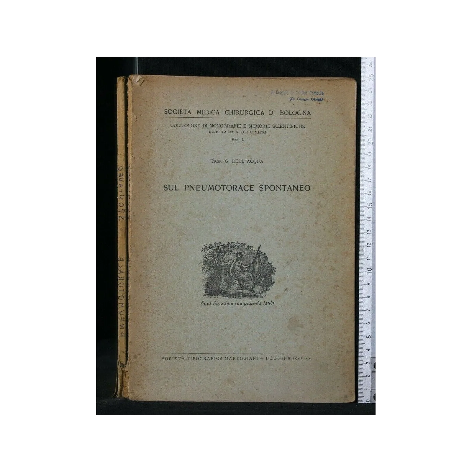 SUL PNEUMOTORACE SPONTANEO