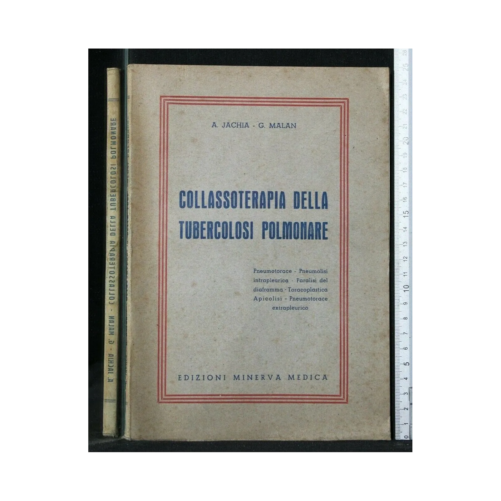 COLLASSOTERAPIA DELLA TUBERCOLOSI POLMONARE