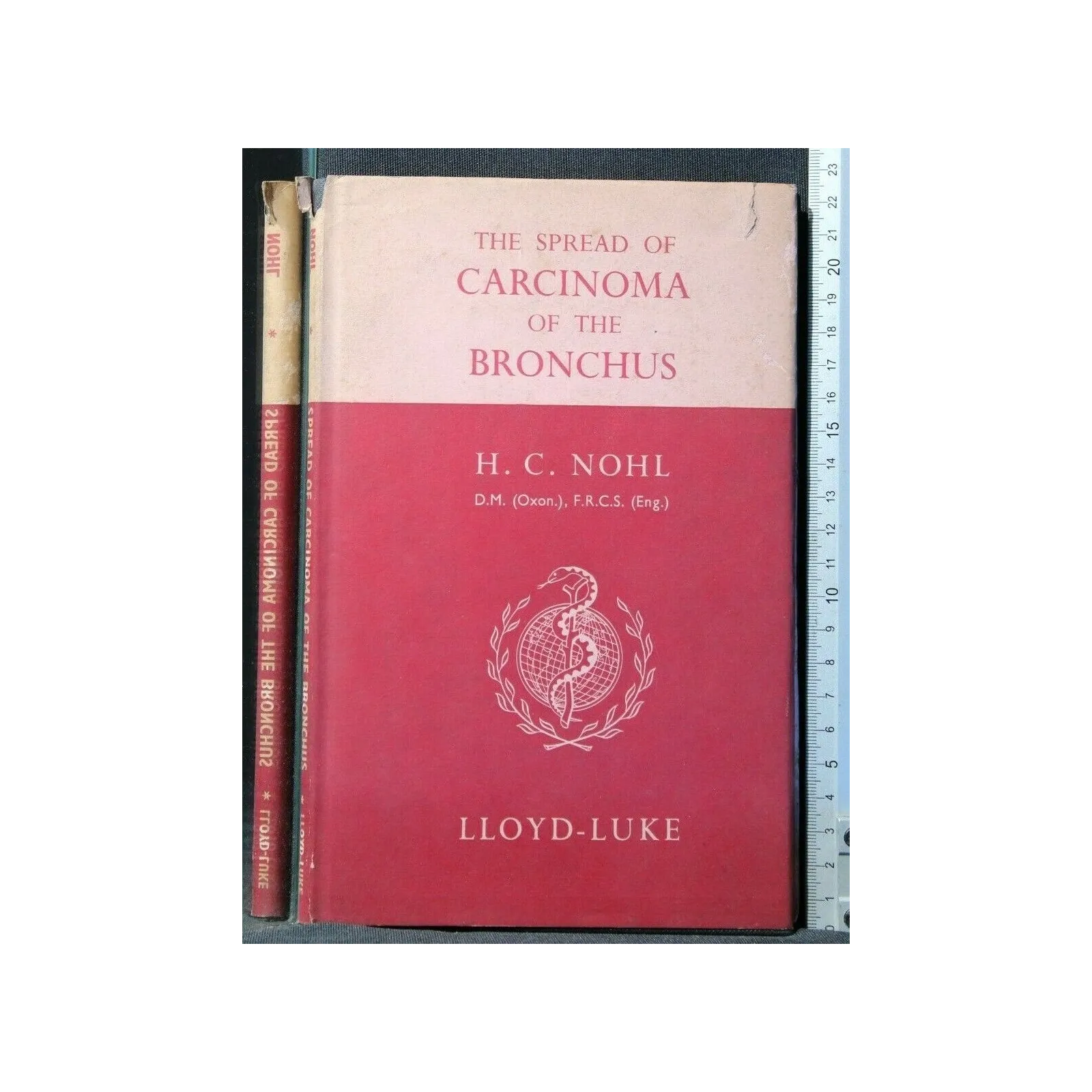 THE SPREAD OF CARCINOMA OF THE BRONCHUS. NOHL. LOYD-LUKE.