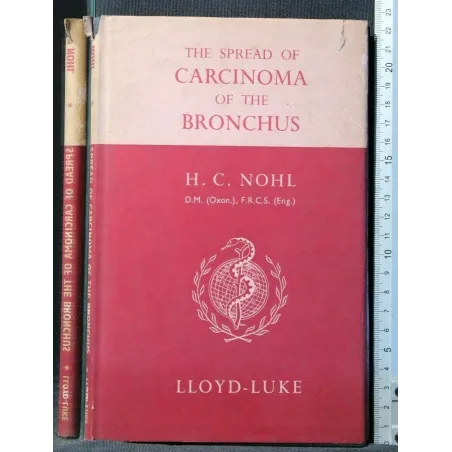THE SPREAD OF CARCINOMA OF THE BRONCHUS. NOHL. LOYD-LUKE.