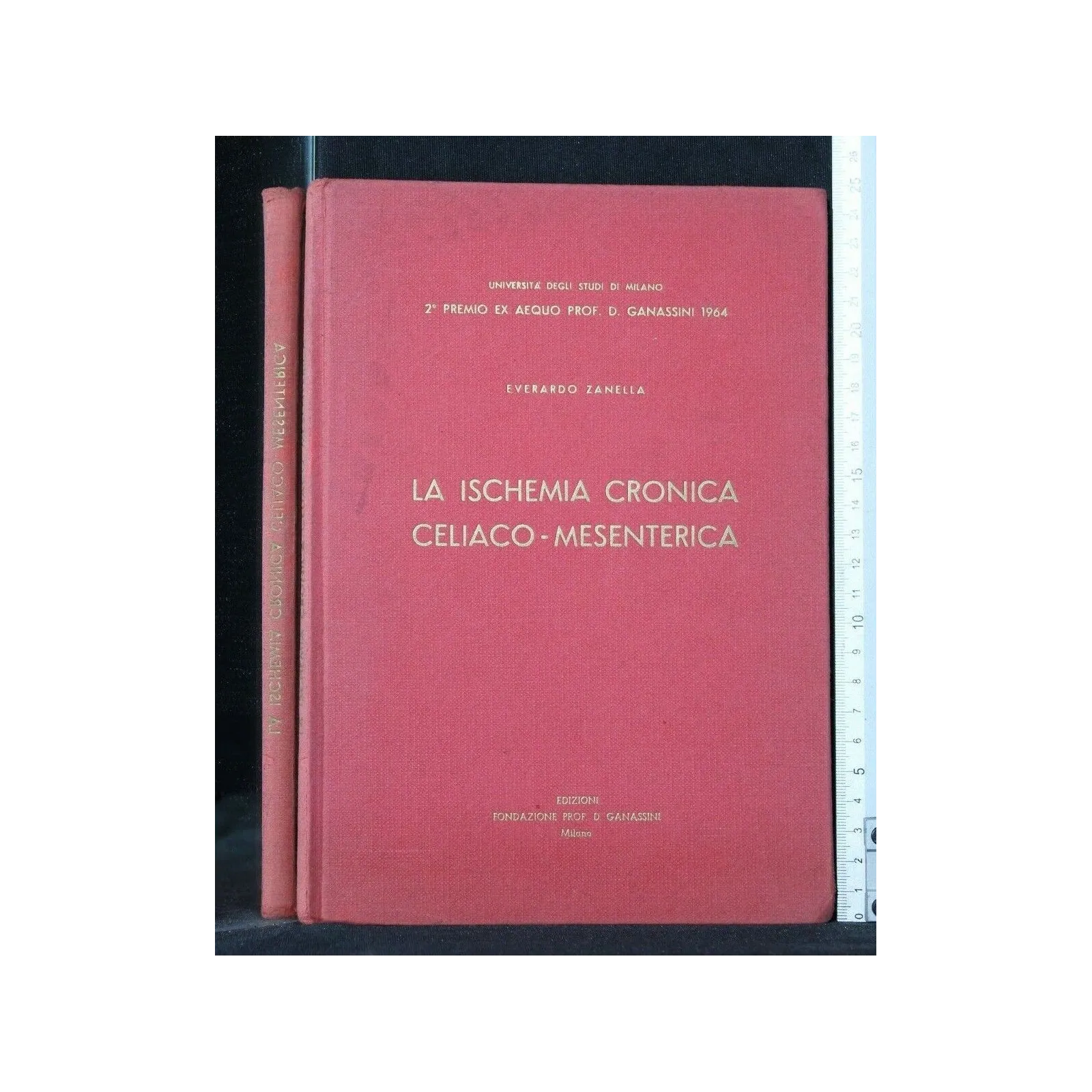 LA ISCHEMIA CRONICA CELIACO-MESENTERICA