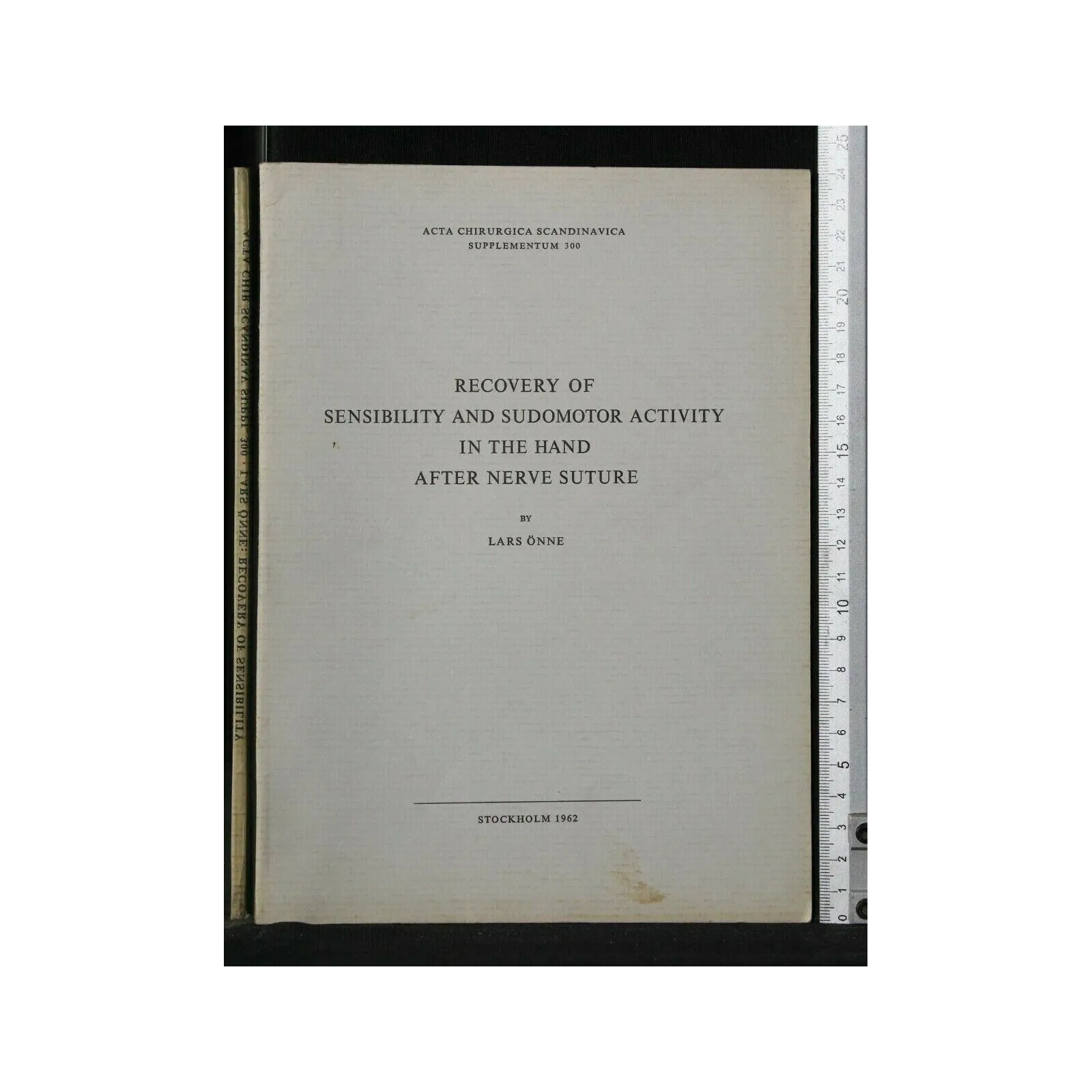 RECOVERY OF SENSIBILITY AND SUDOMOTOR ACTIVITY IN THE HAND AFTER