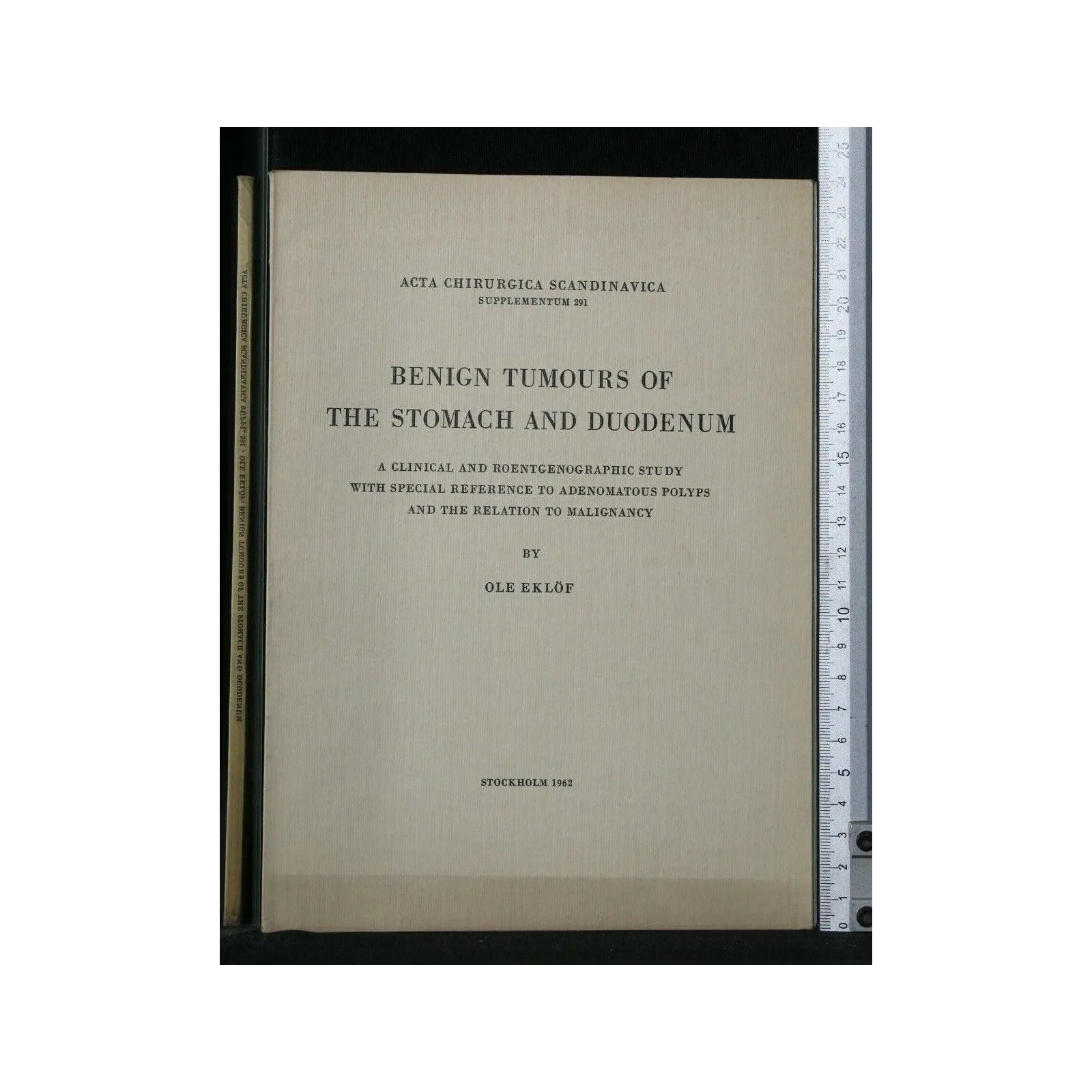 BENIGN TUMOURS OF THE STOMACH AND DUODENUM