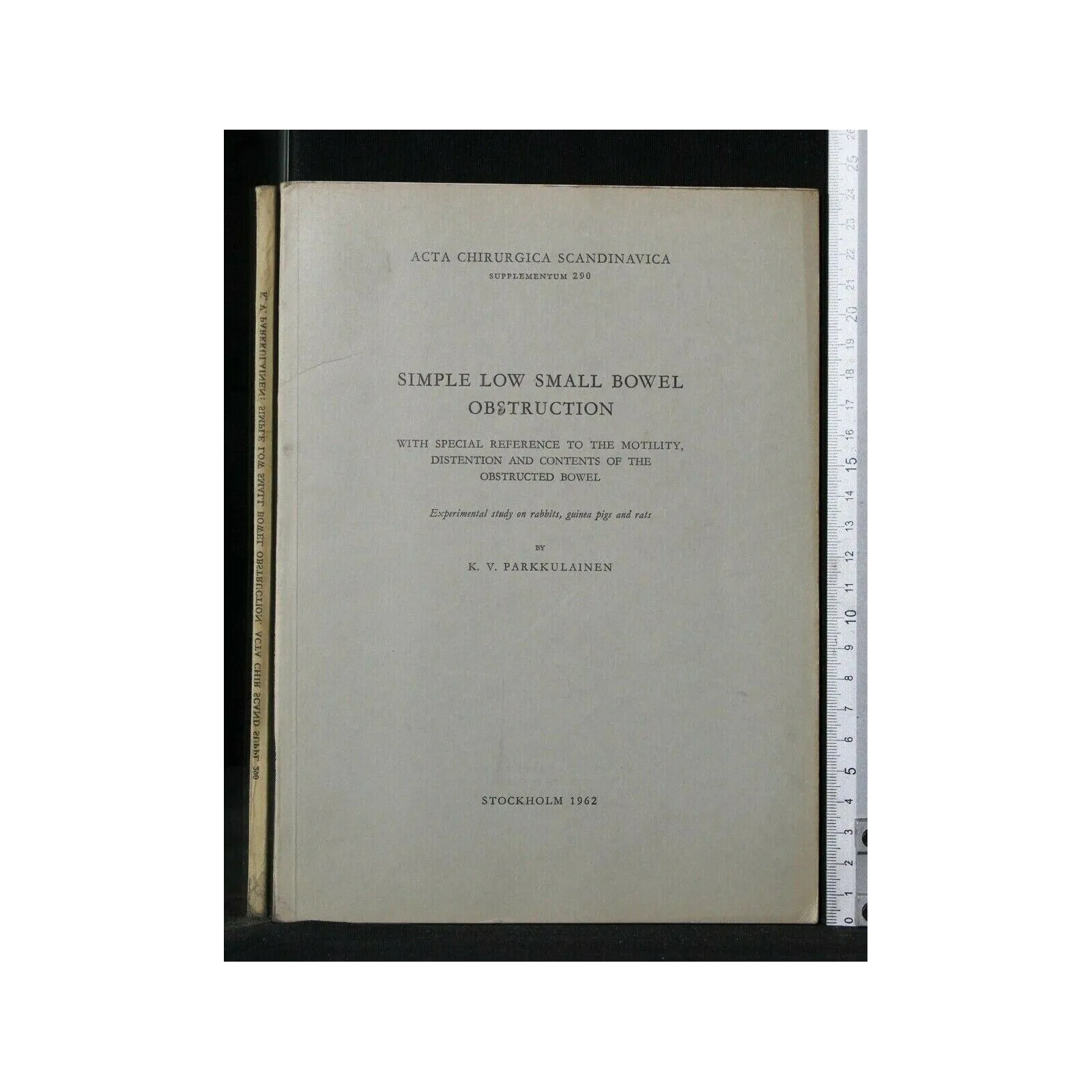 SIMPLE LOW SMALL BOWEL OBSTRUCTION
