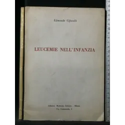 LEUCEMIE NELL'INFANZIA