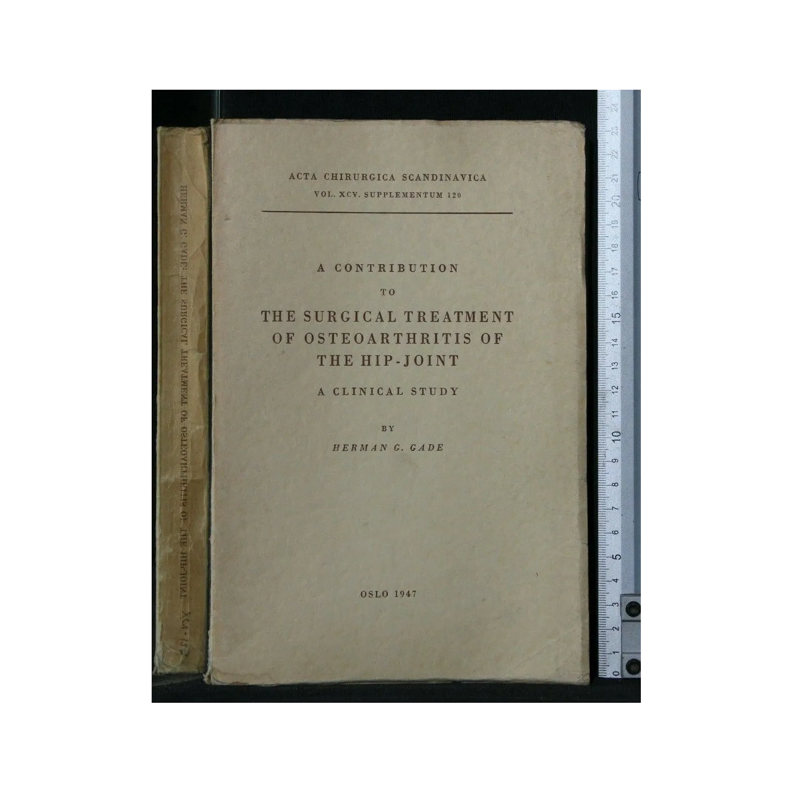 A CONTRIBUTION TO THE SURGICAL TREATMENT OF OSTEOARTHRITIS OF