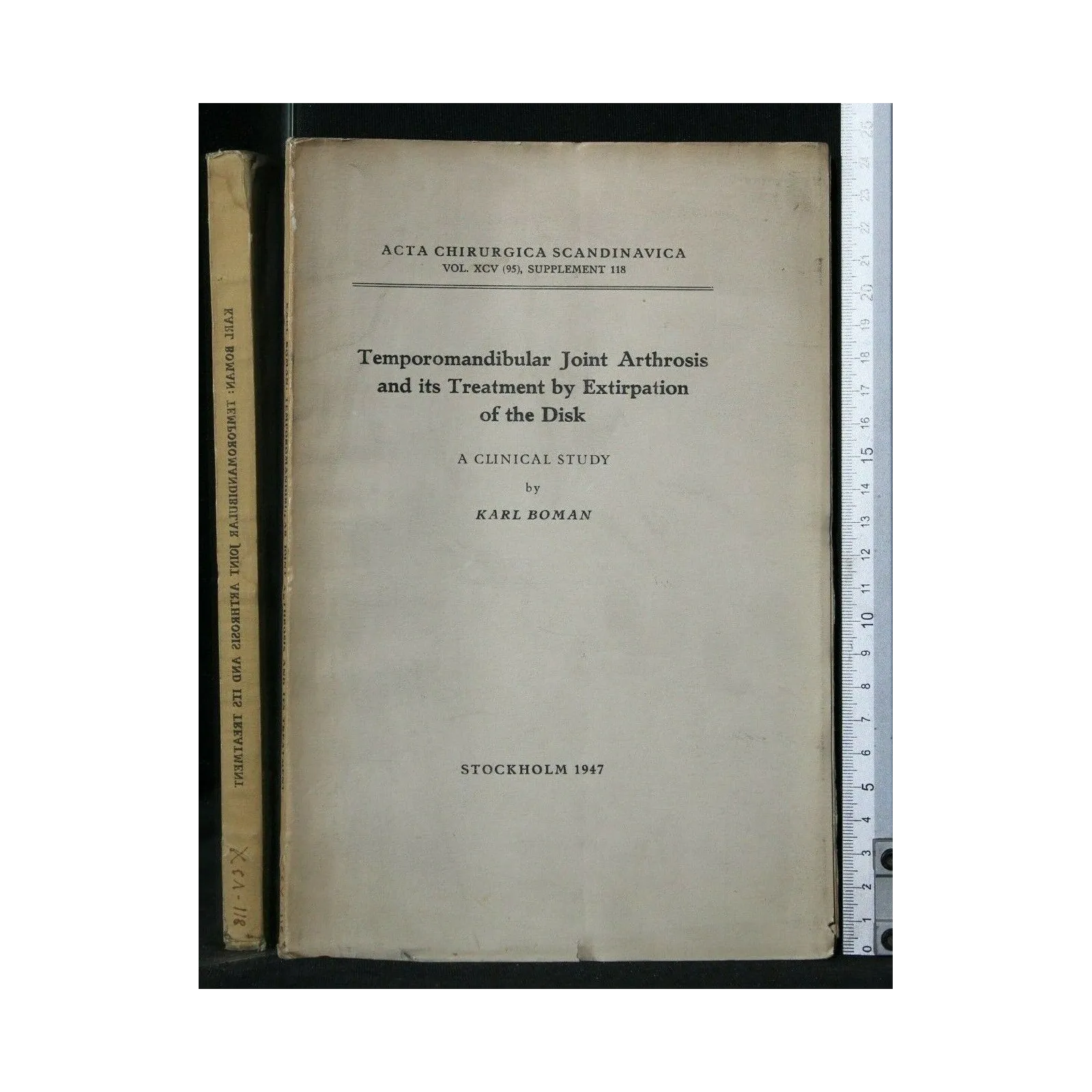 TEMPOROMANDIBULAR JOINT ARTHROSIS AND ITS TREATMENT BY