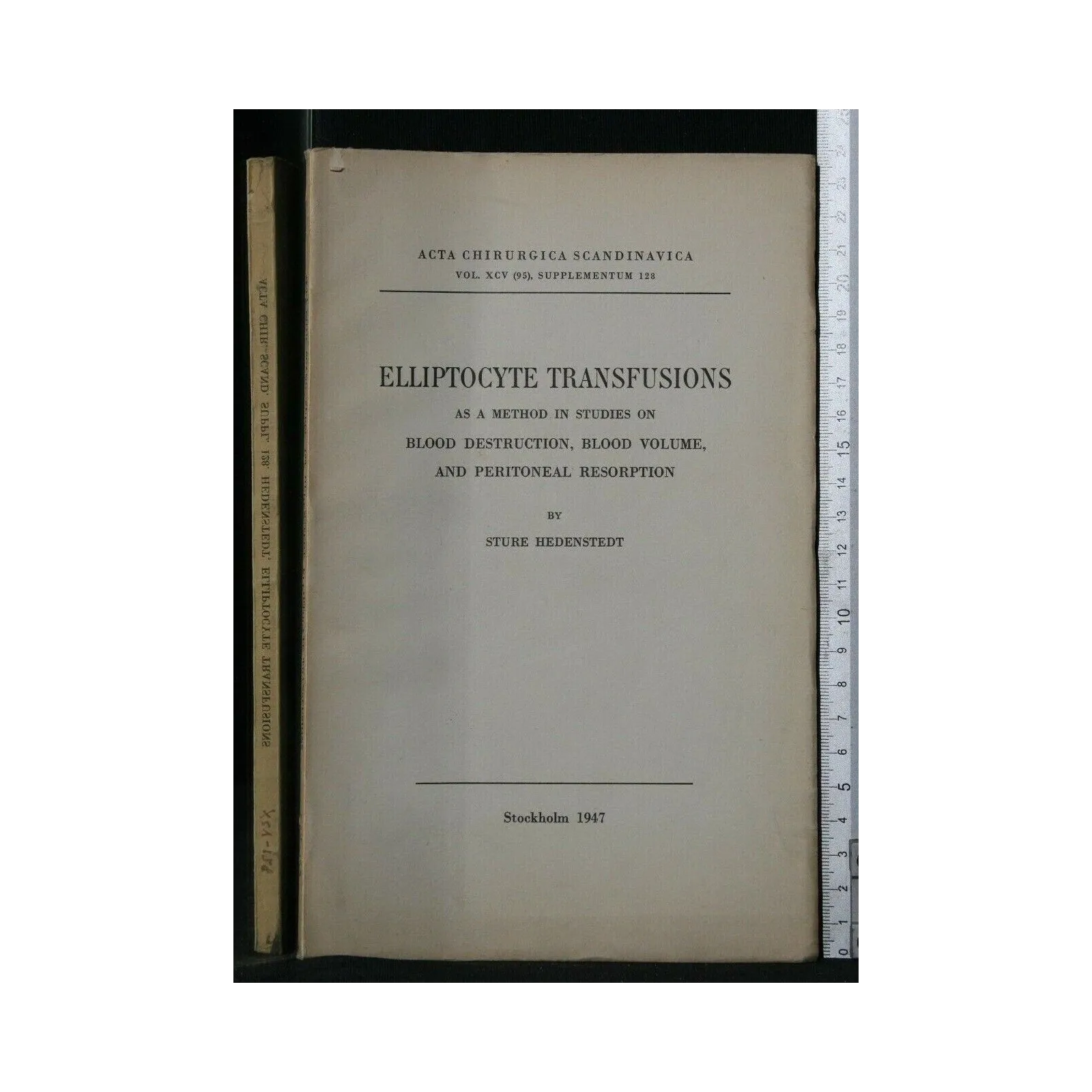 ELLIPTOCYTE TRANSFUSIONS