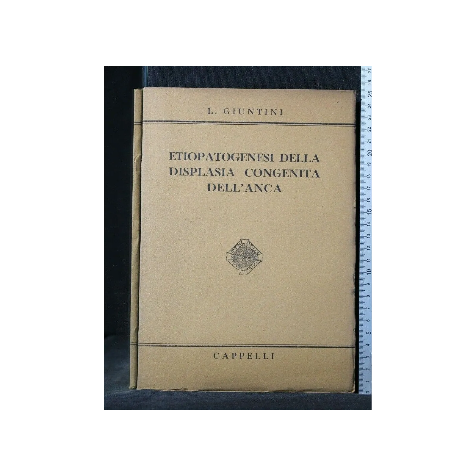 ETIOPATOGENESI DELLA DISPLASIA CONGENITA DELL'ANCA