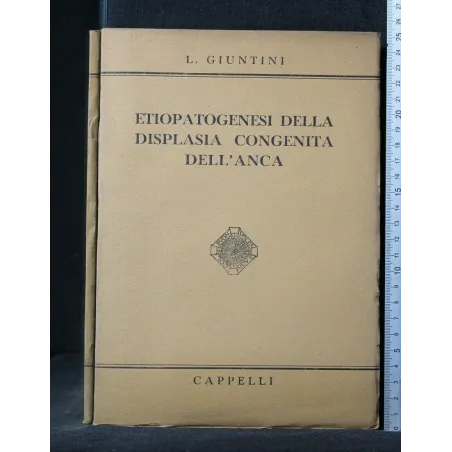 ETIOPATOGENESI DELLA DISPLASIA CONGENITA DELL'ANCA