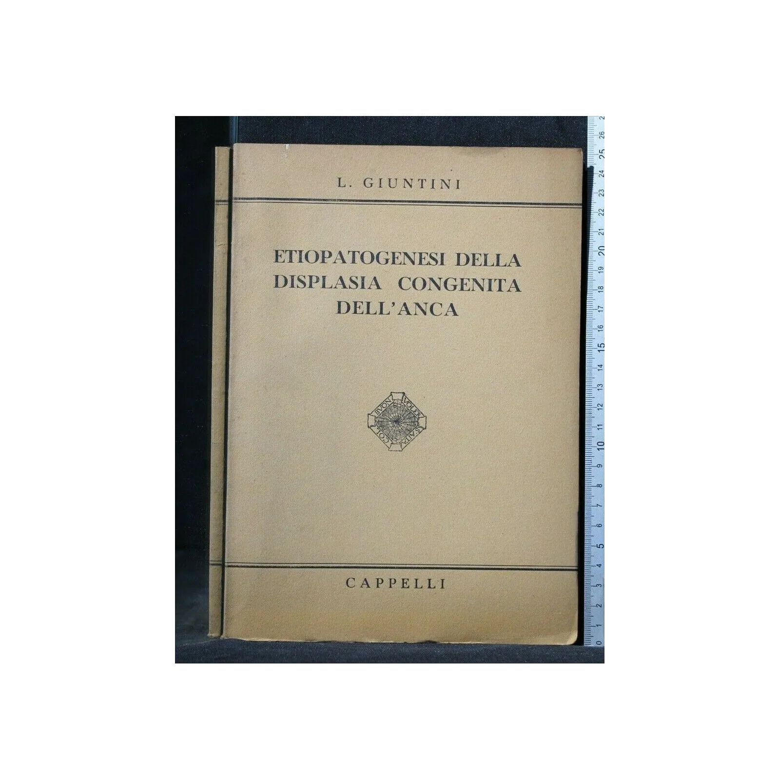 ETIOPATOGENESI DELLA DISPLASIA CONGENITA DELL'ANCA