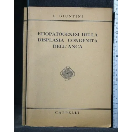 ETIOPATOGENESI DELLA DISPLASIA CONGENITA DELL'ANCA
