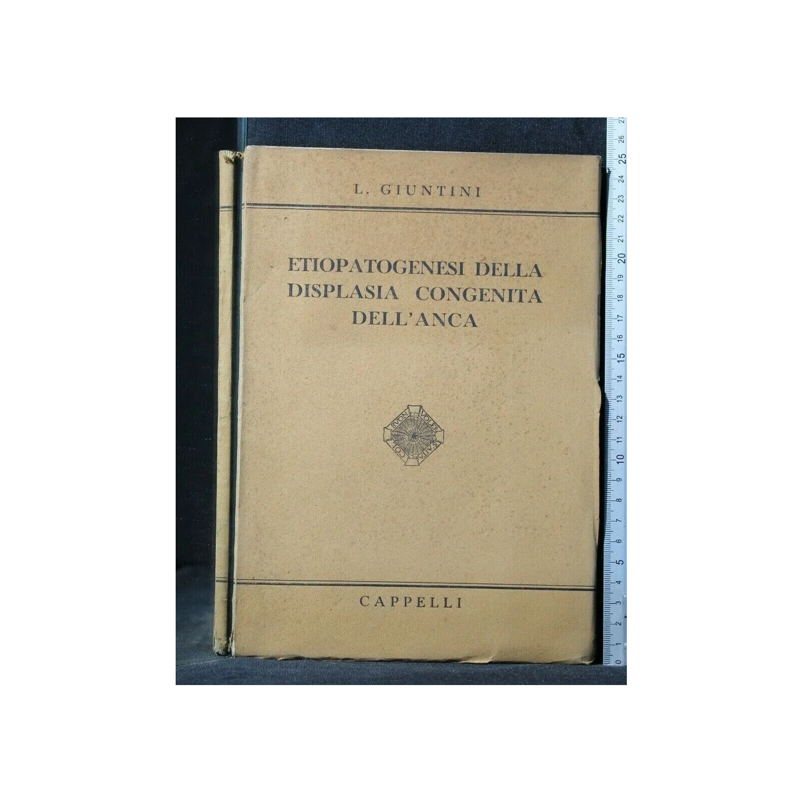 ETIOPATOGENESI DELLA DISPLASIA CONGENITA DELL'ANCA