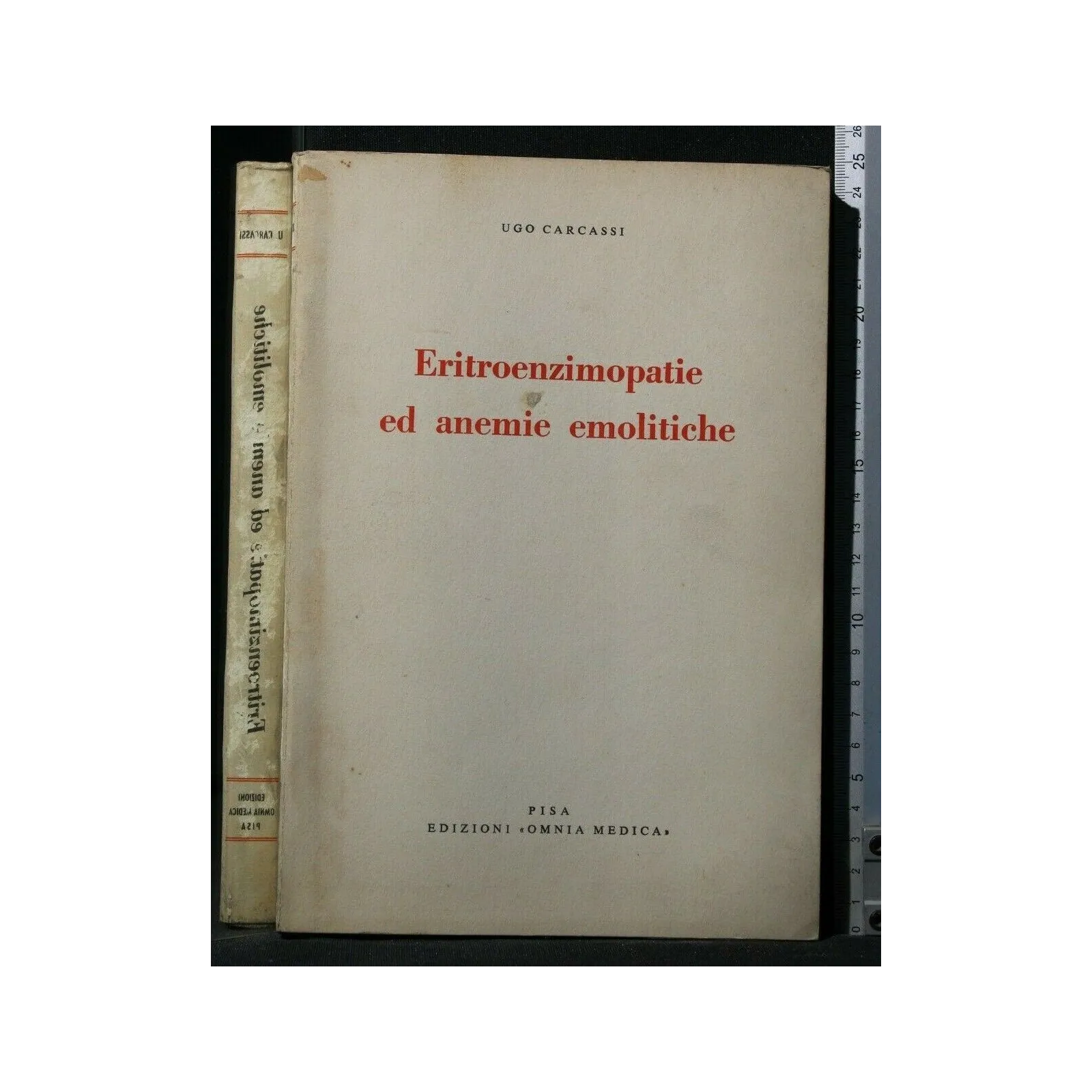 ERITROENZIMOPATIE ED ANEMIE EMOLITICHE