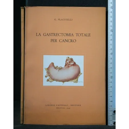 LA GASTRECTOMIA TOTALE PER CANCRO