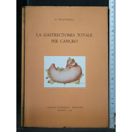 LA GASTRECTOMIA TOTALE PER CANCRO