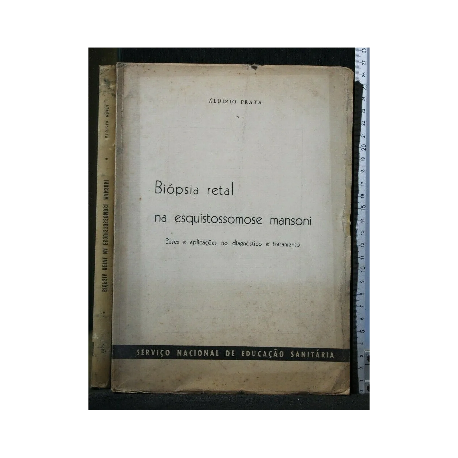BIOPSIA RETAL NA ESQUISTOSSOMOSE MANSONI