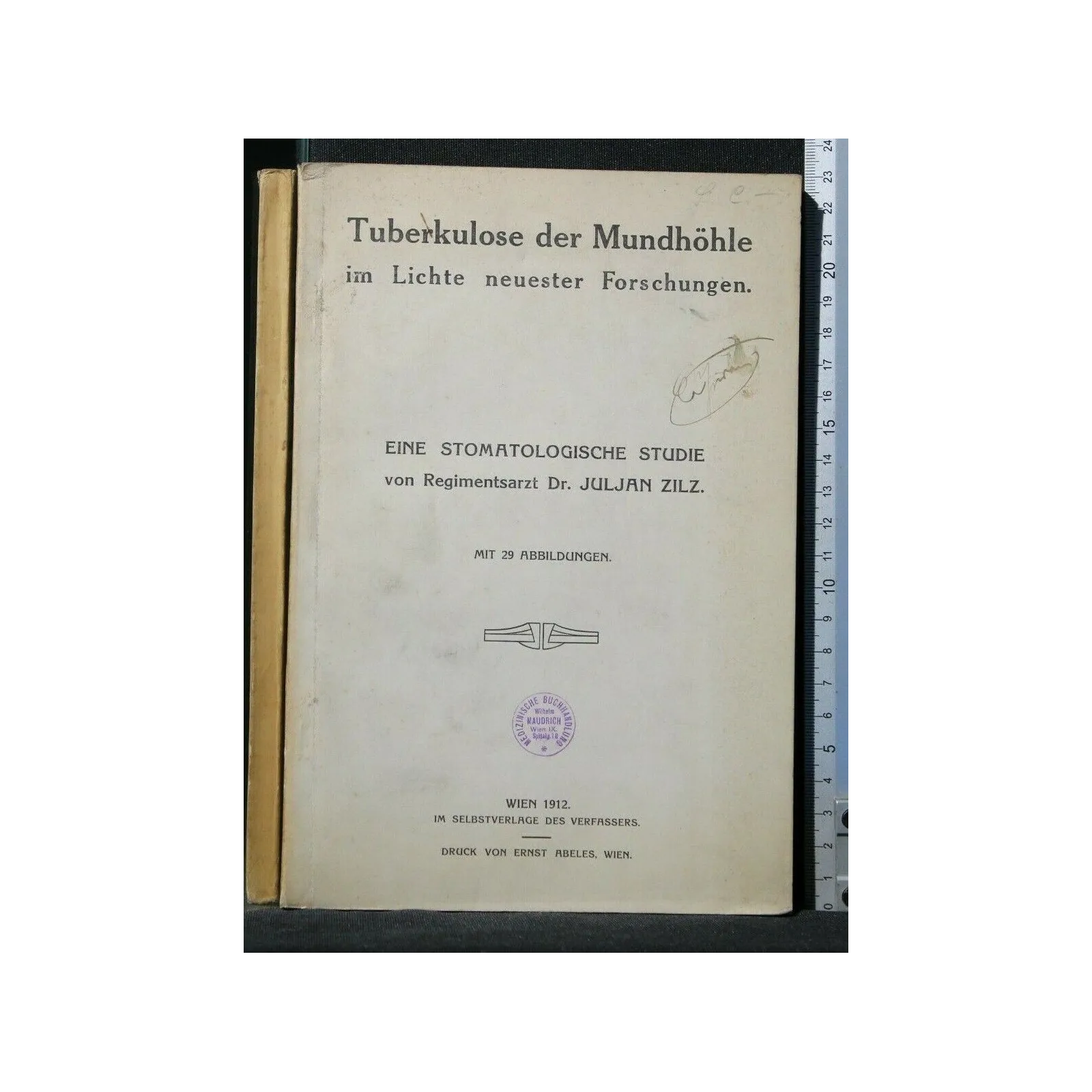 TUBERKULOSE DER MUNDHOHLE IM LICHTE NEUESTER FORSCHUNGEN