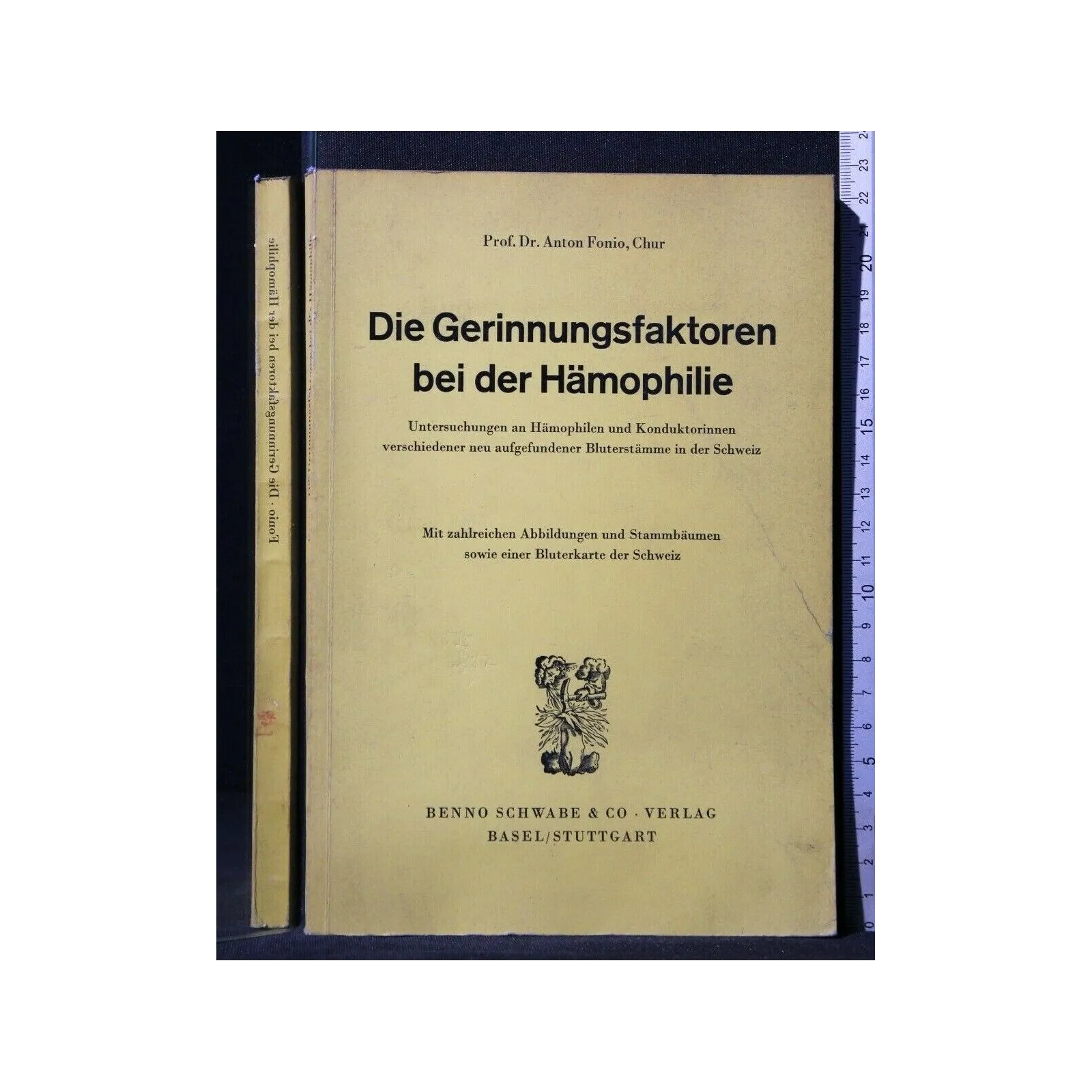 DIE GERINNUNGSFAKTOREN BEI DER HAMOPHILIE