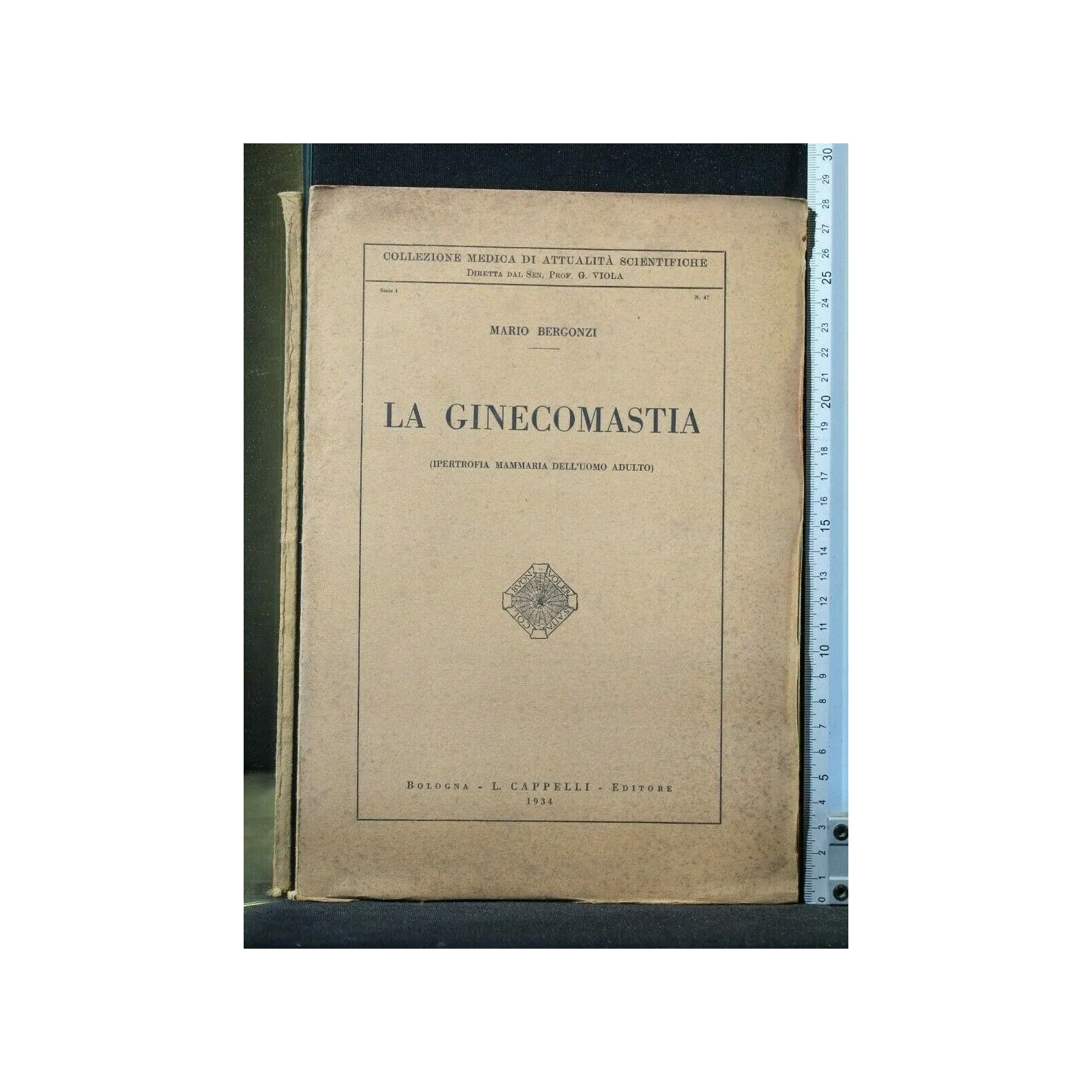 LA GINECOMASTIA