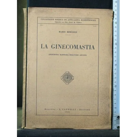 LA GINECOMASTIA
