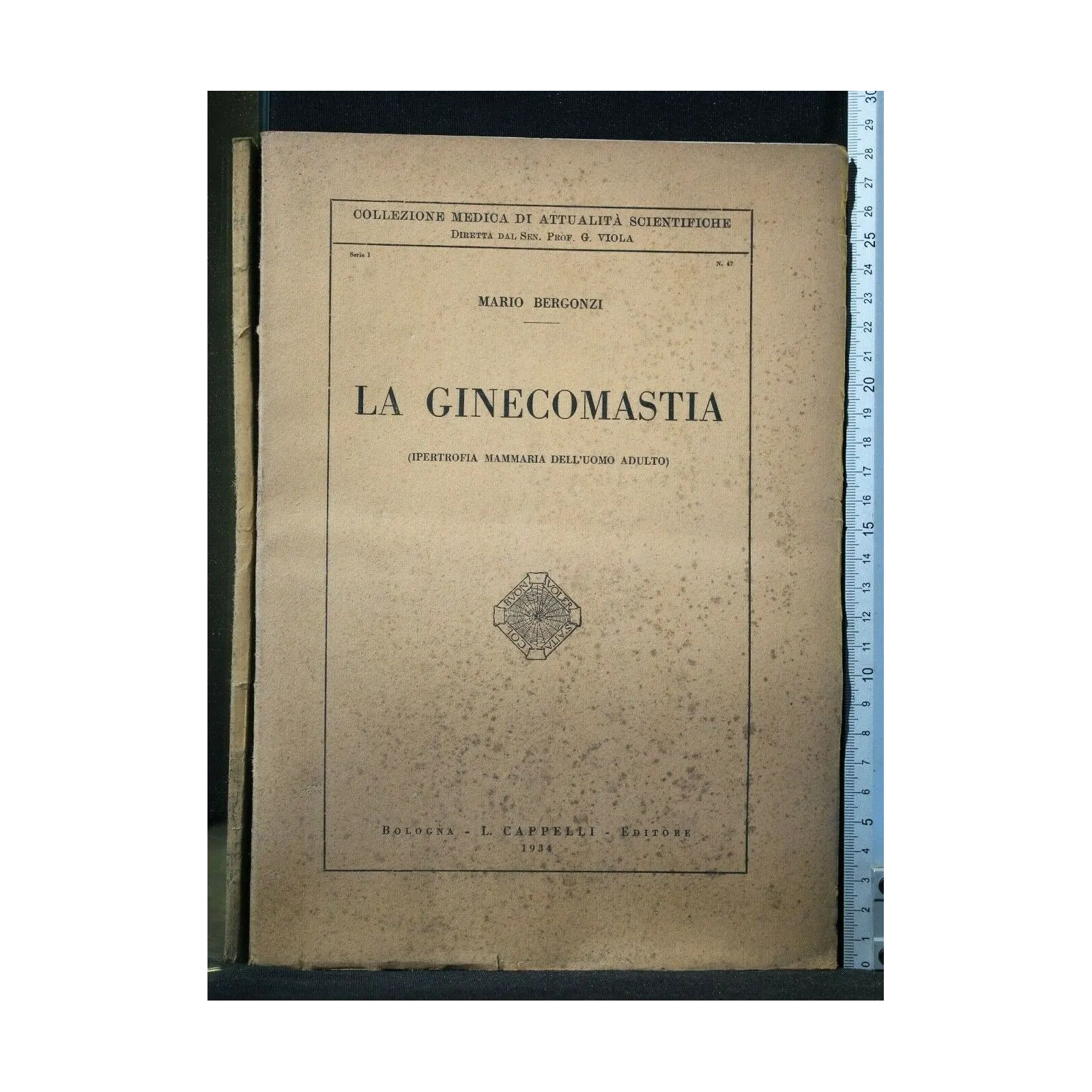 LA GINECOMASTIA