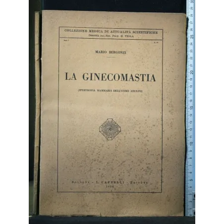 LA GINECOMASTIA