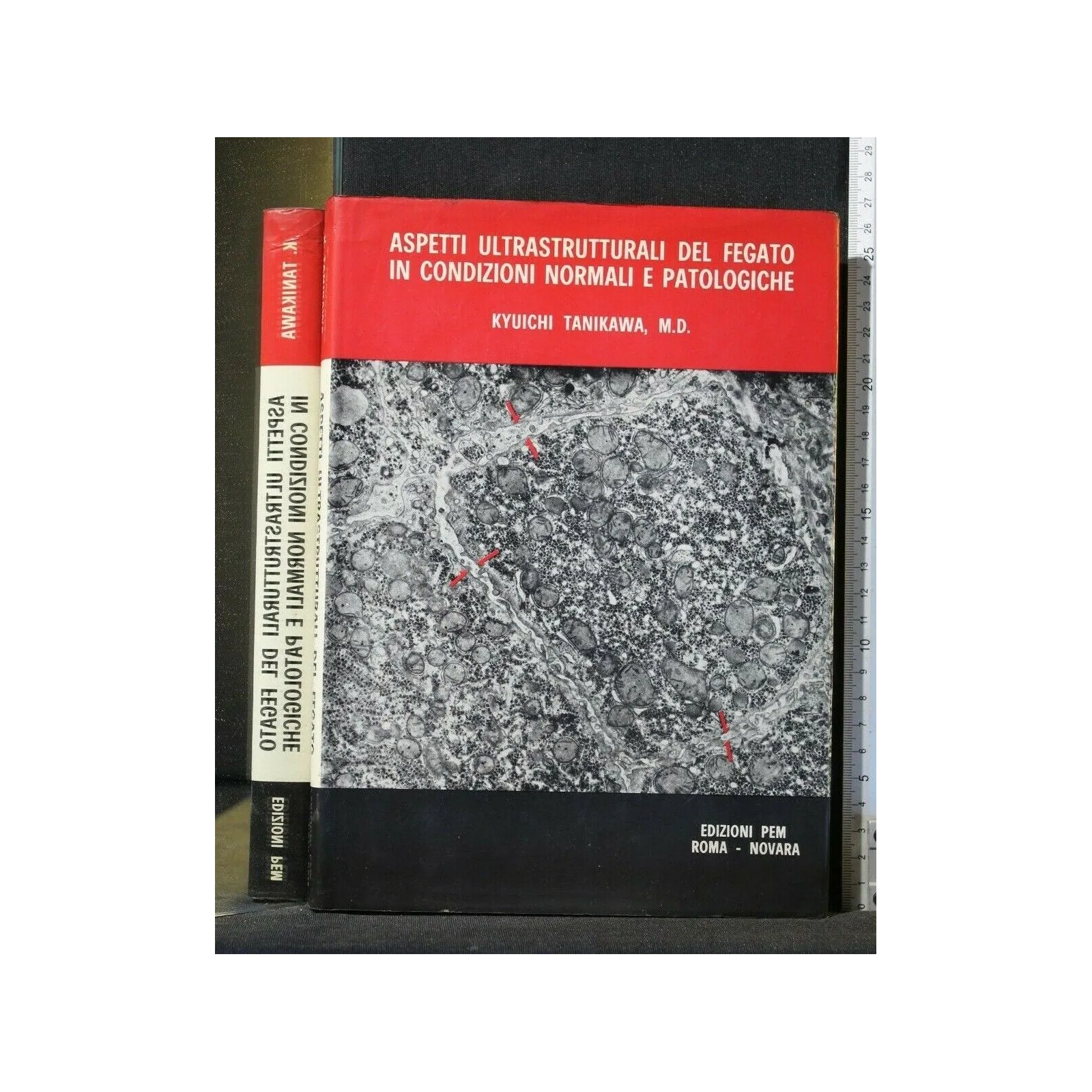 ASPETTI ULTRASTRUTTURALI DEL FEGATO IN CONDIZIONI NORMALI E